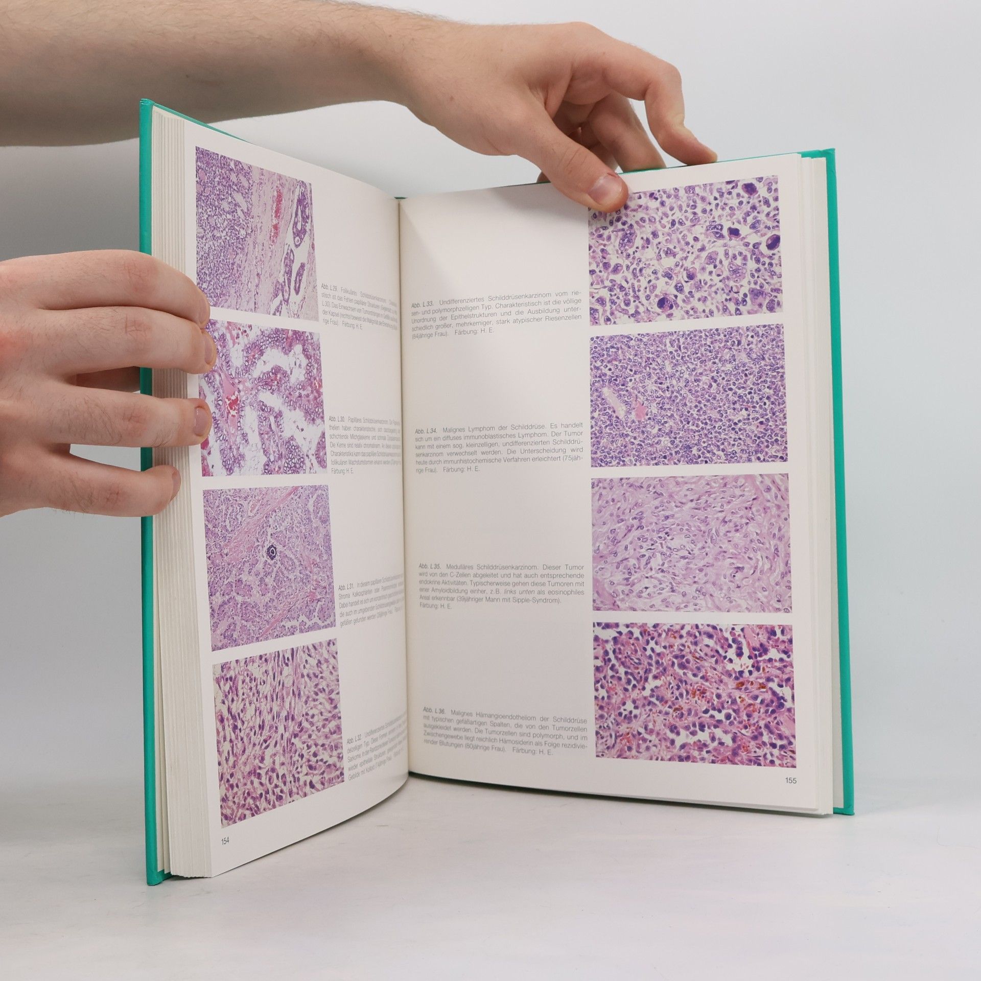 Ekkehard Grundmann Spezielle Pathologie