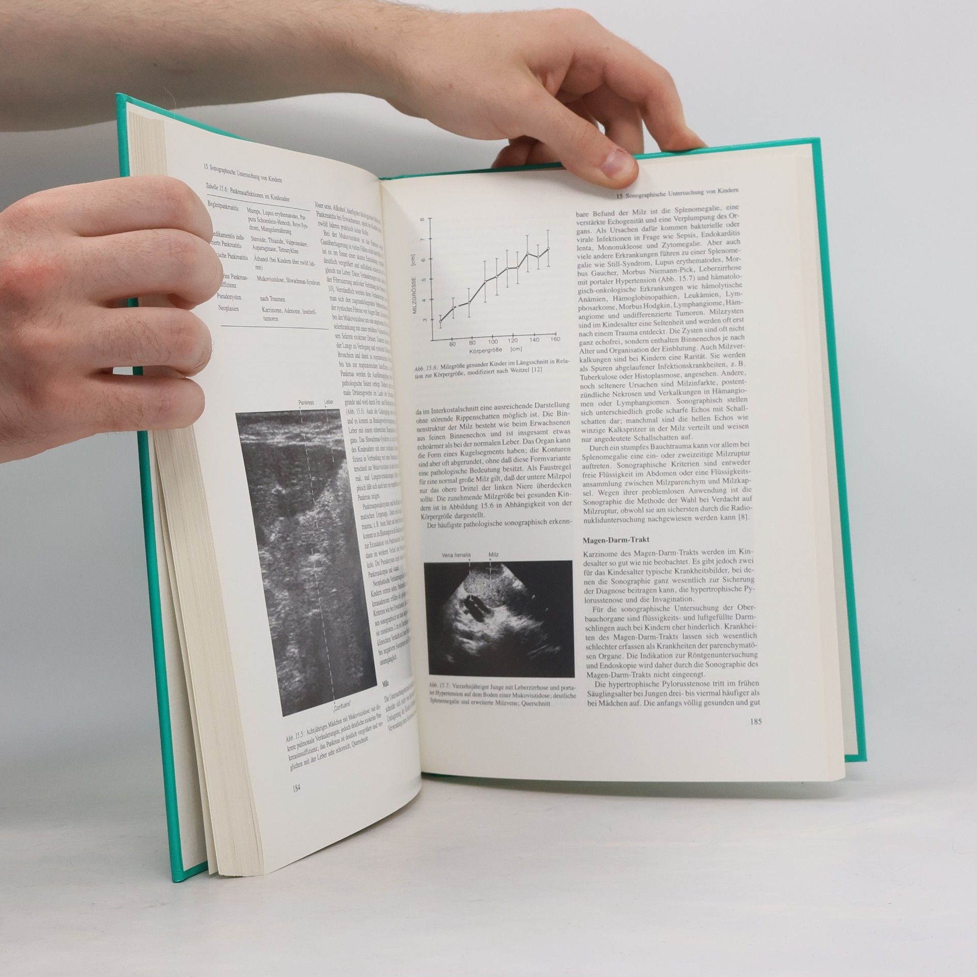Heinrich Kremer Sonographische Diagnostik - 3. Auflage
