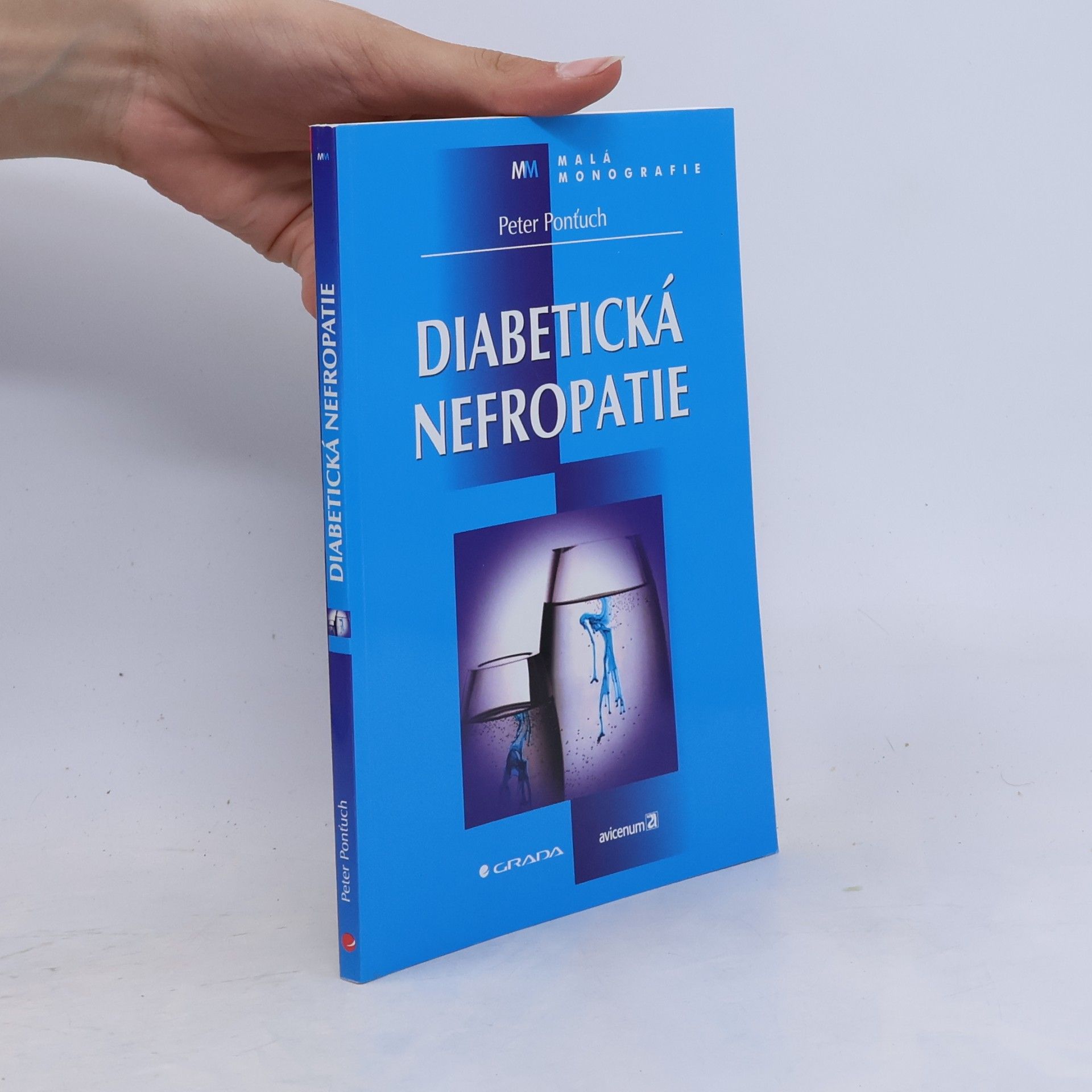 Diabetická nefropatie