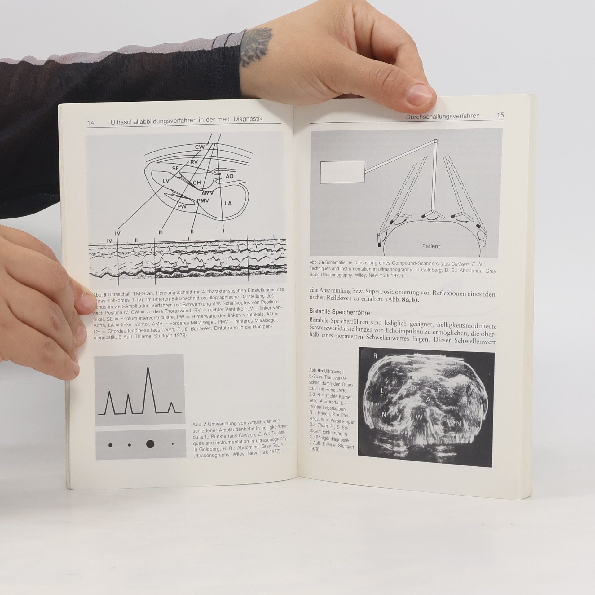 Hermann Frommhold Sonographie des Abdomens