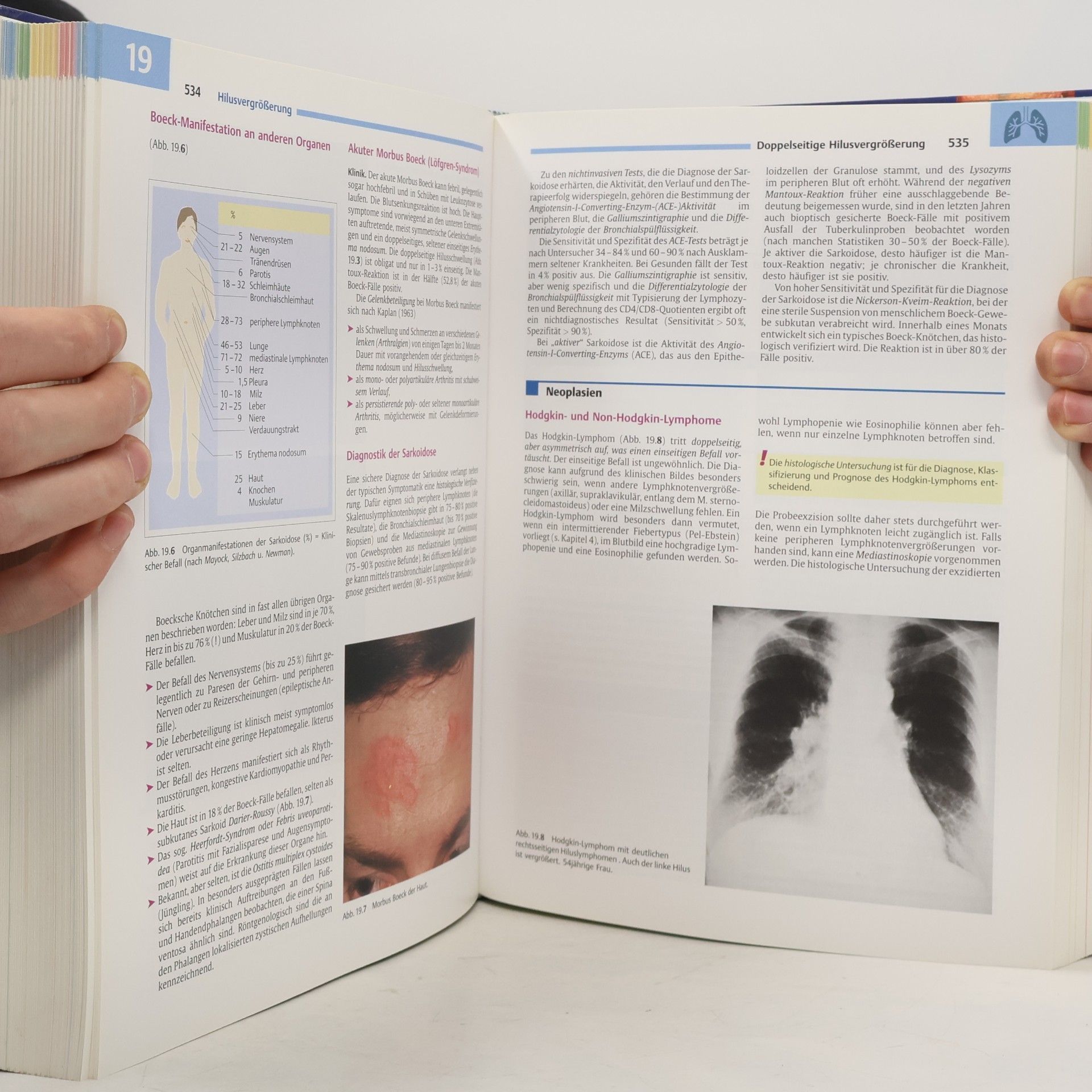 Walter Siegenthaler Differentialdiagnose innerer Krankheiten