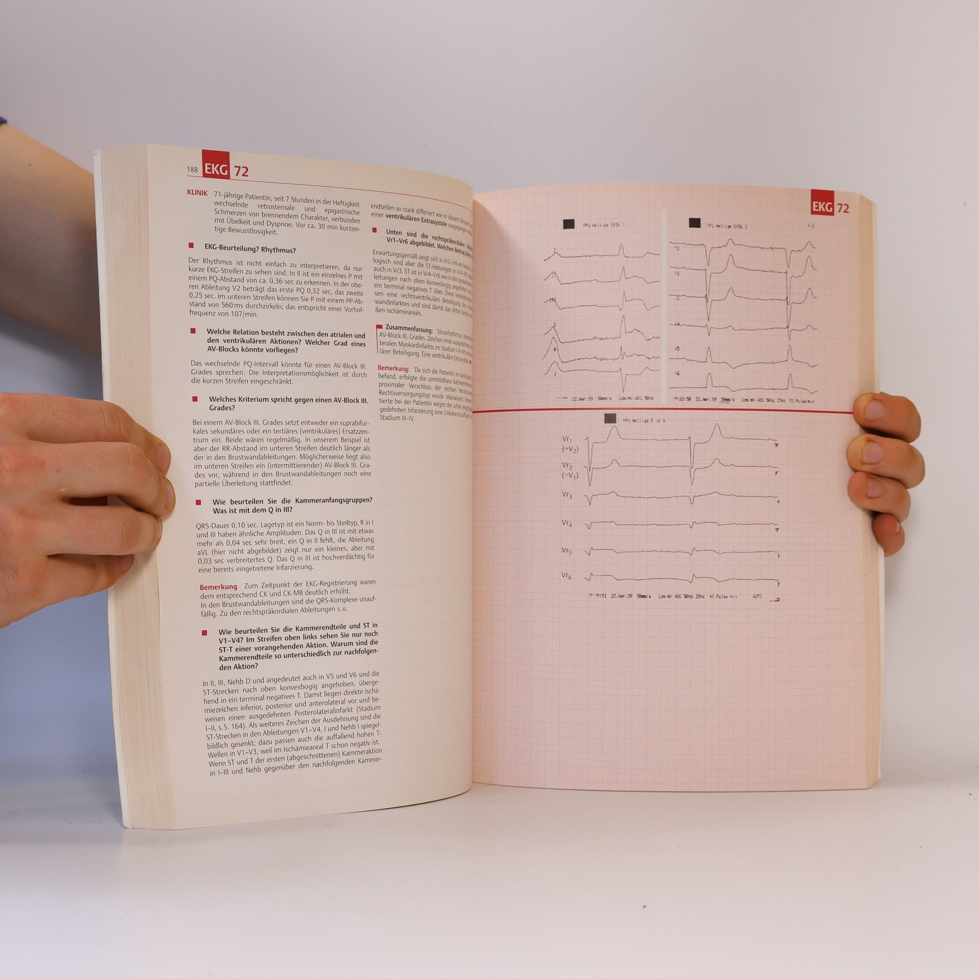 Thomas Horacek Der EKG-Trainer - 2. Auflage - mit EKG-Lineal