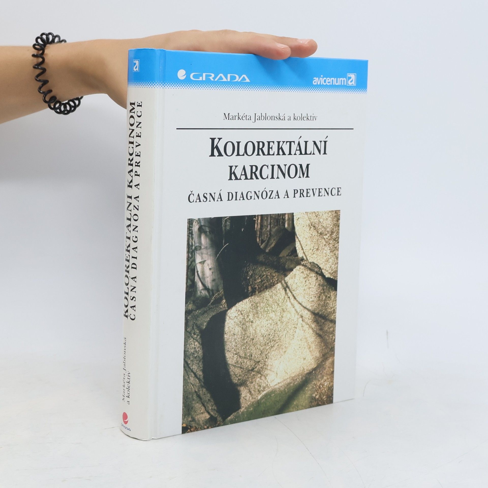Markéta Jablonská Kolorektální karcinom : časná diagnóza a prevence