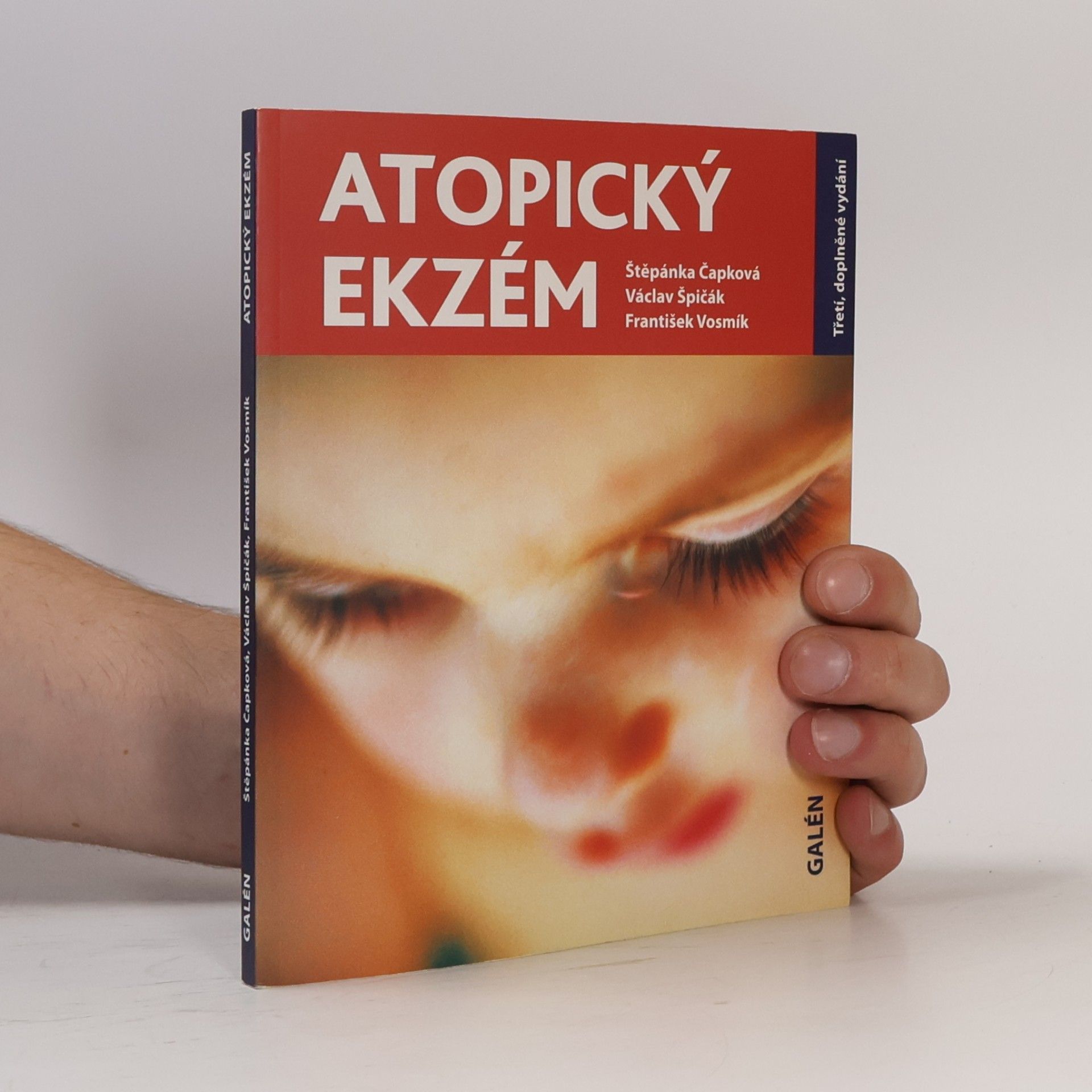 Štěpánka Čapková Atopický ekzém