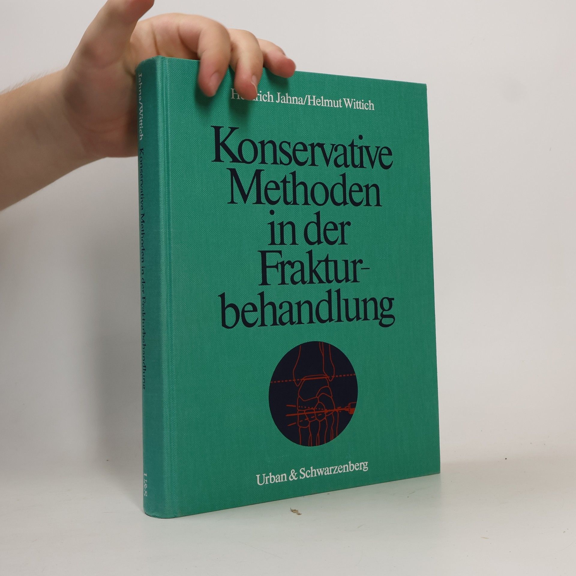 Helmut Wittich Konservative Methoden in der Frakturbehandlung