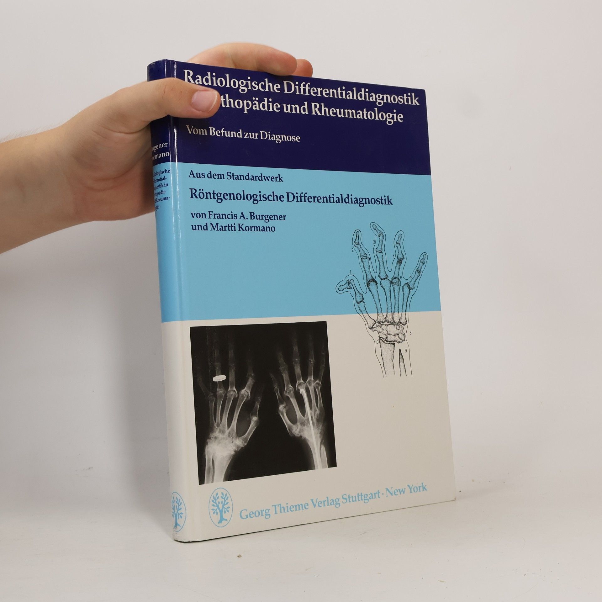 Francis A. Burgener Radiologische Differentialdiagnostik in Orthopädie und Rheumatologie