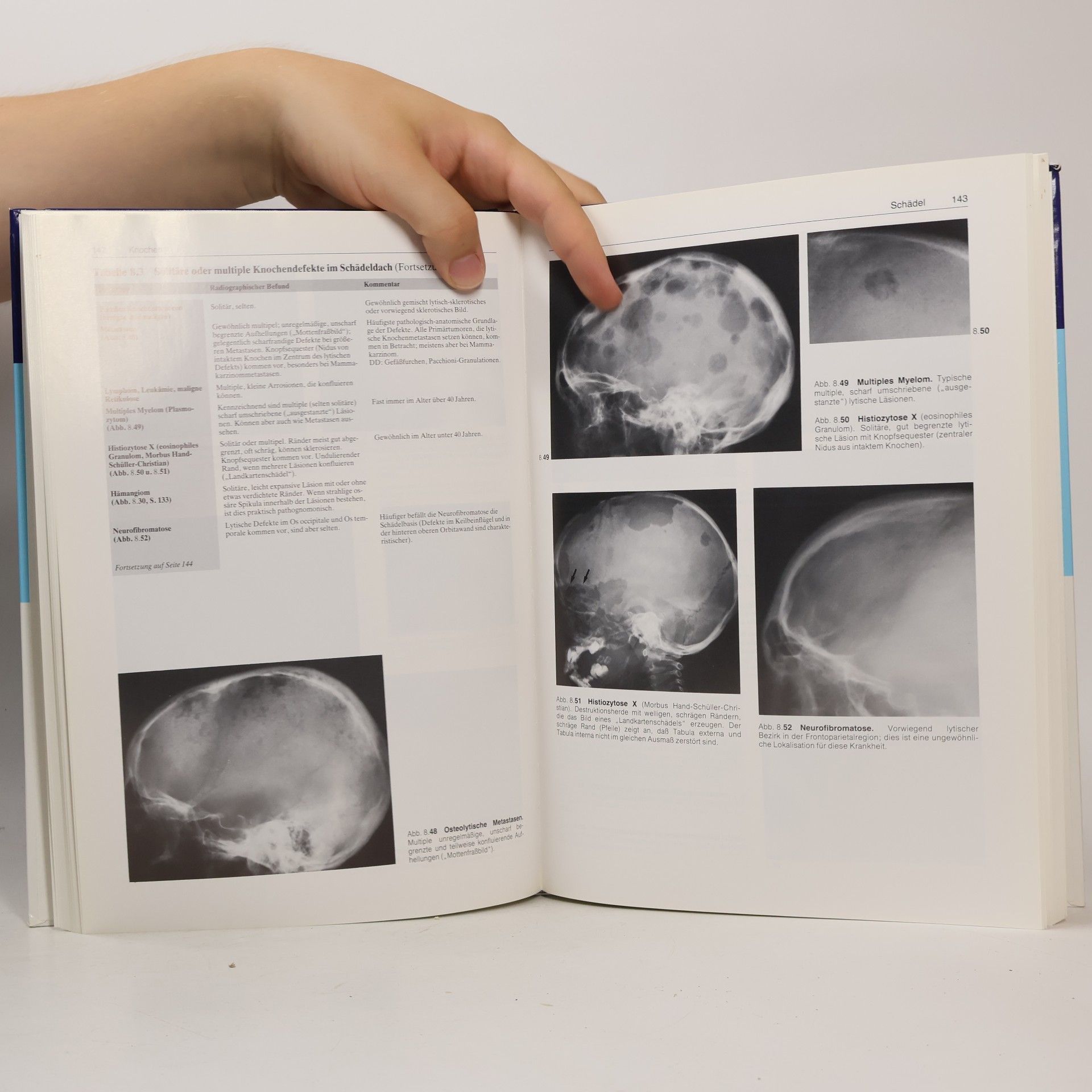 Francis A. Burgener Radiologische Differentialdiagnostik in Orthopädie und Rheumatologie