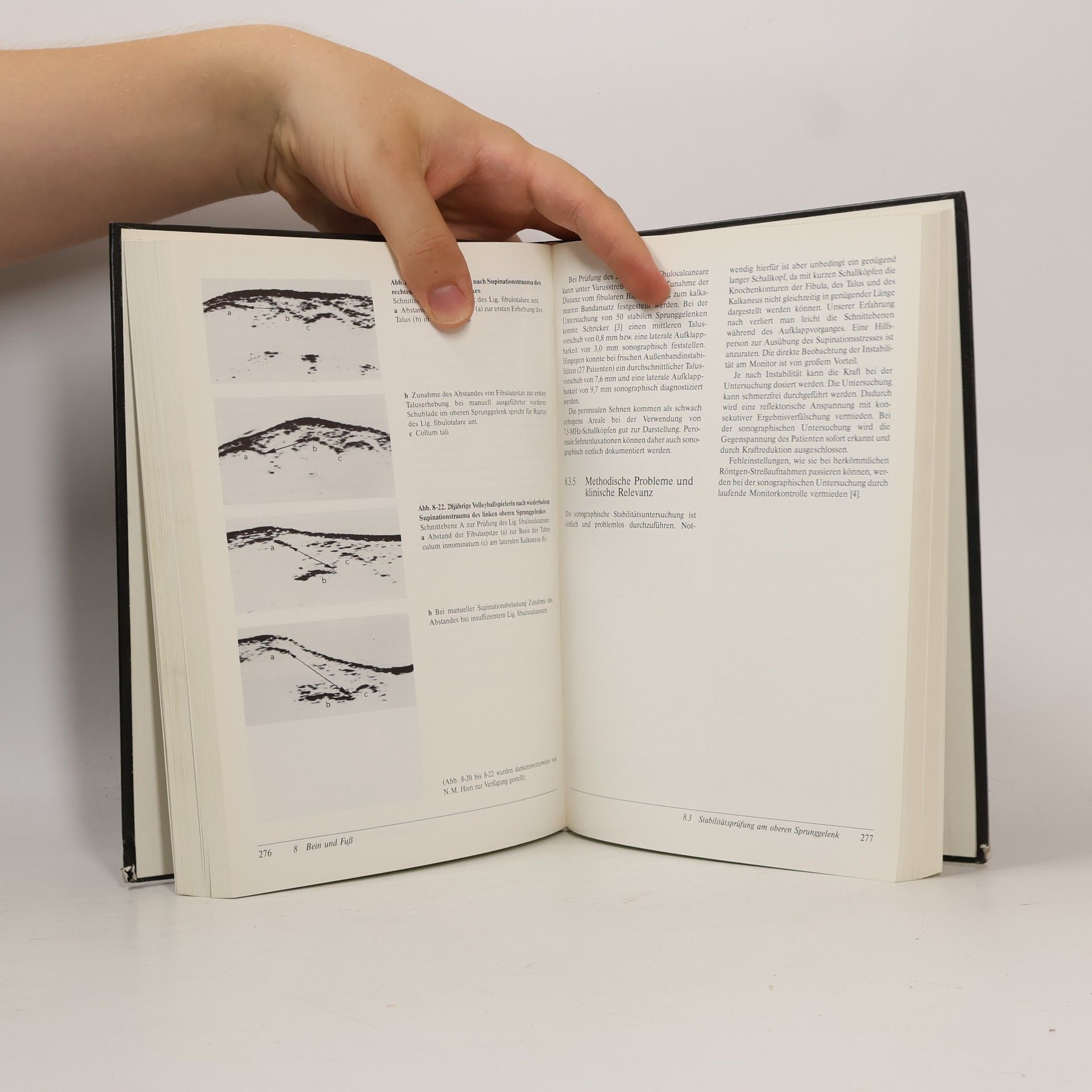 Reinhard Graf Sonographie am Stütz- und Bewegungsapparat bei Erwachsenen und Kindern