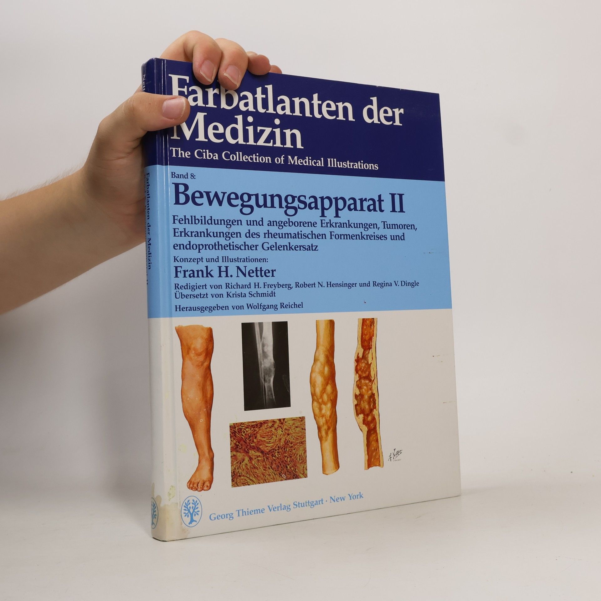 Frank Henry Netter Farbatlanten der Medizin, Bd.8, Bewegungsapparat