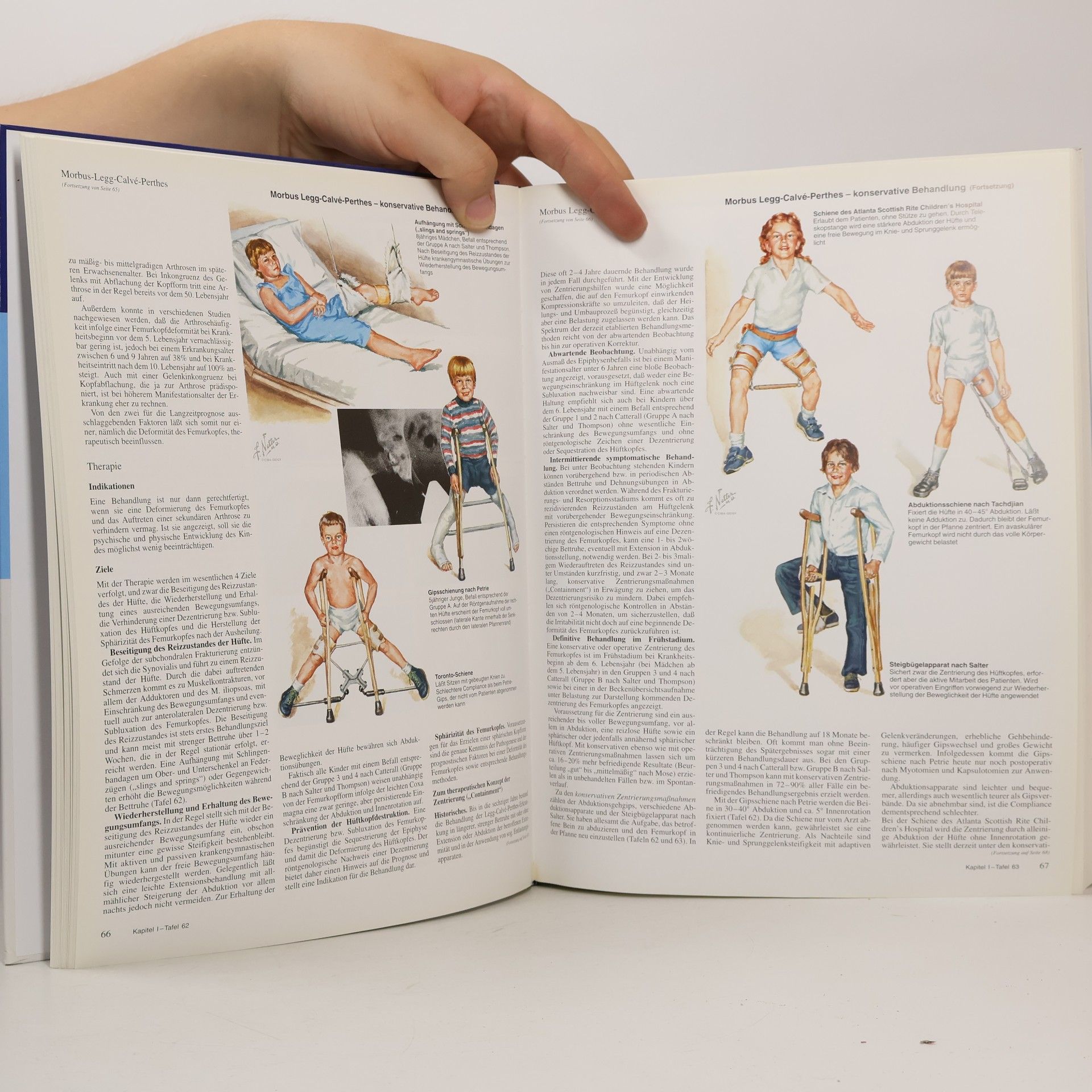Frank Henry Netter Farbatlanten der Medizin, Bd.8, Bewegungsapparat