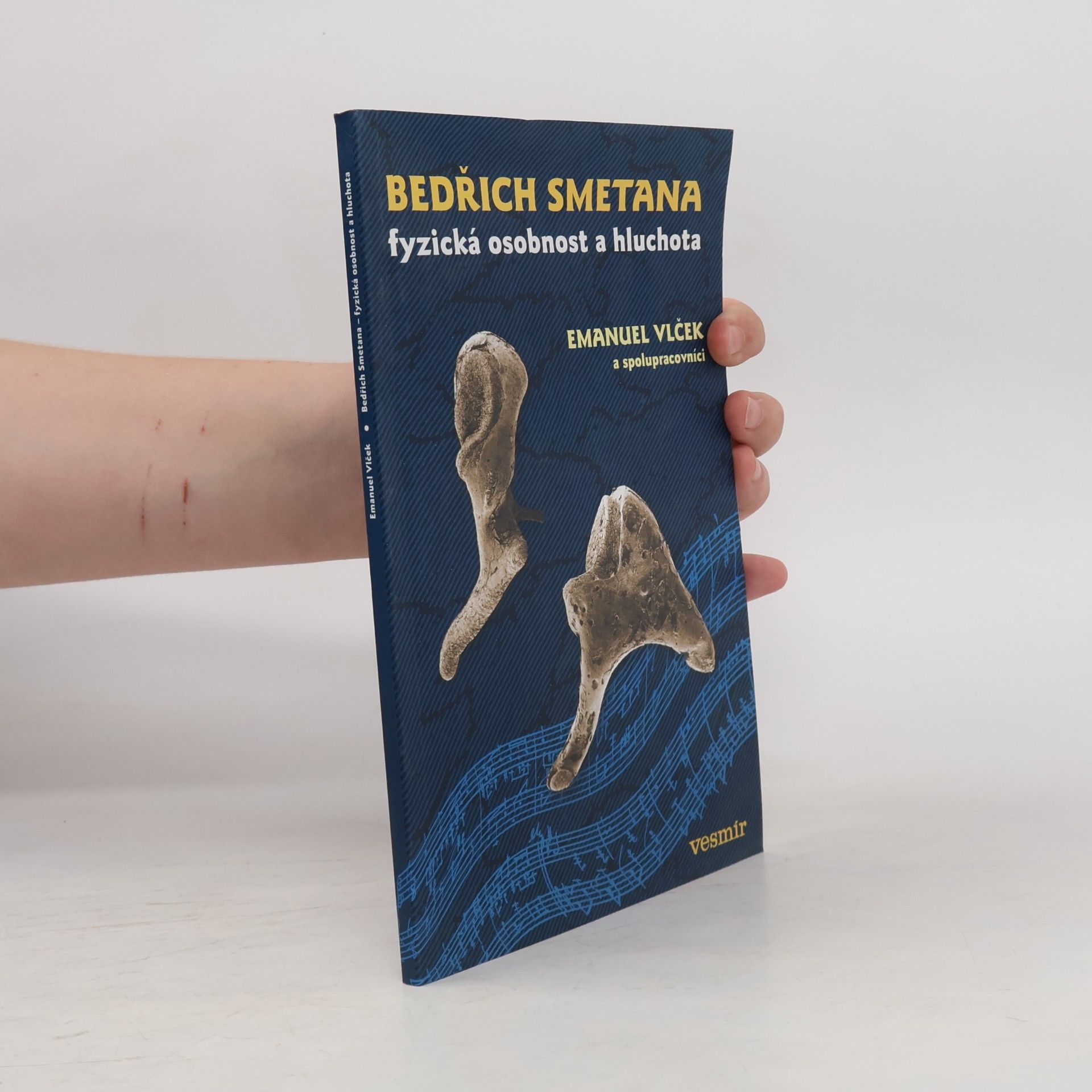 Emanuel Vlček Bedřich Smetana. Fyzická osobnost a hluchota