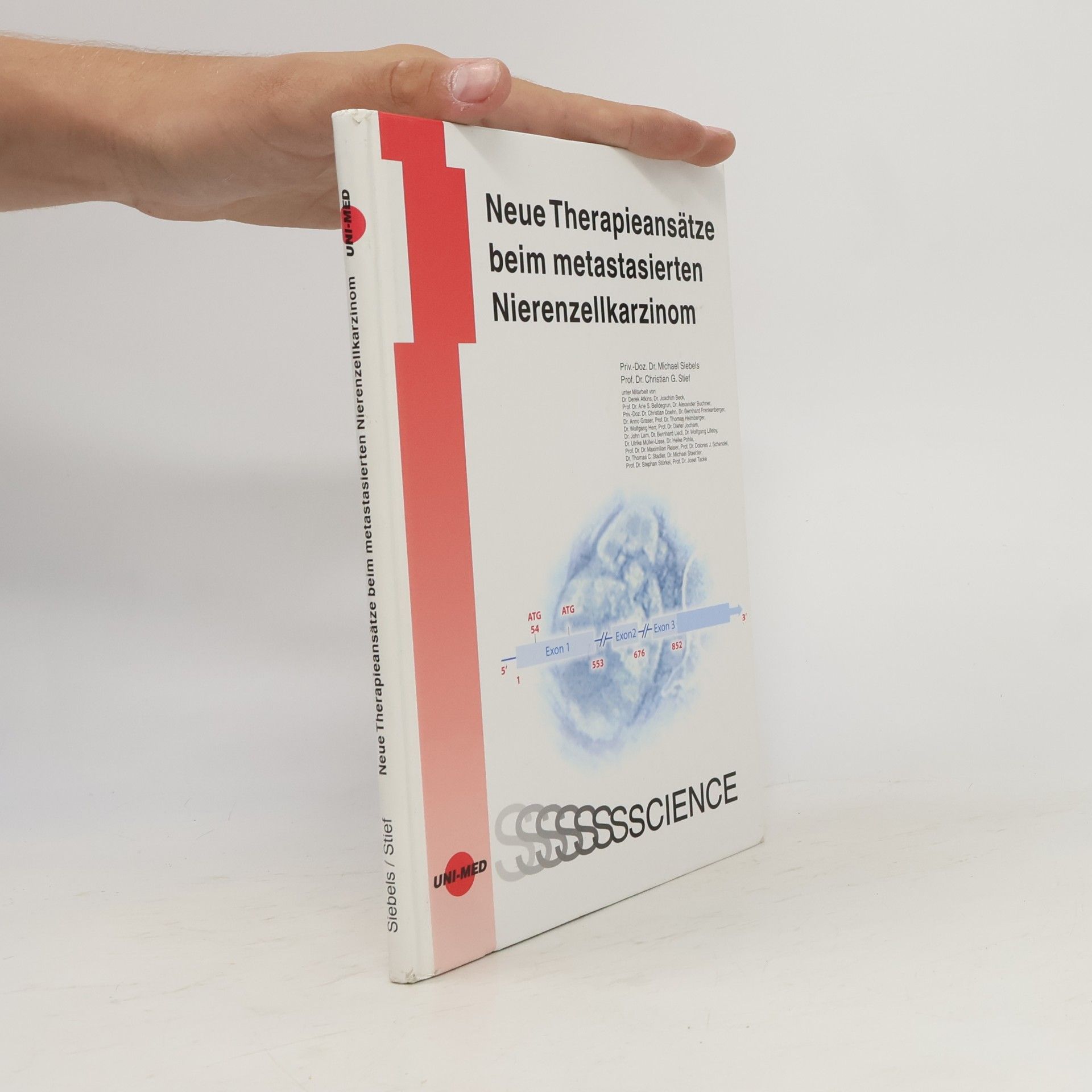 Neue Therapieansätze beim metastasierten Nierenzellkarzinom