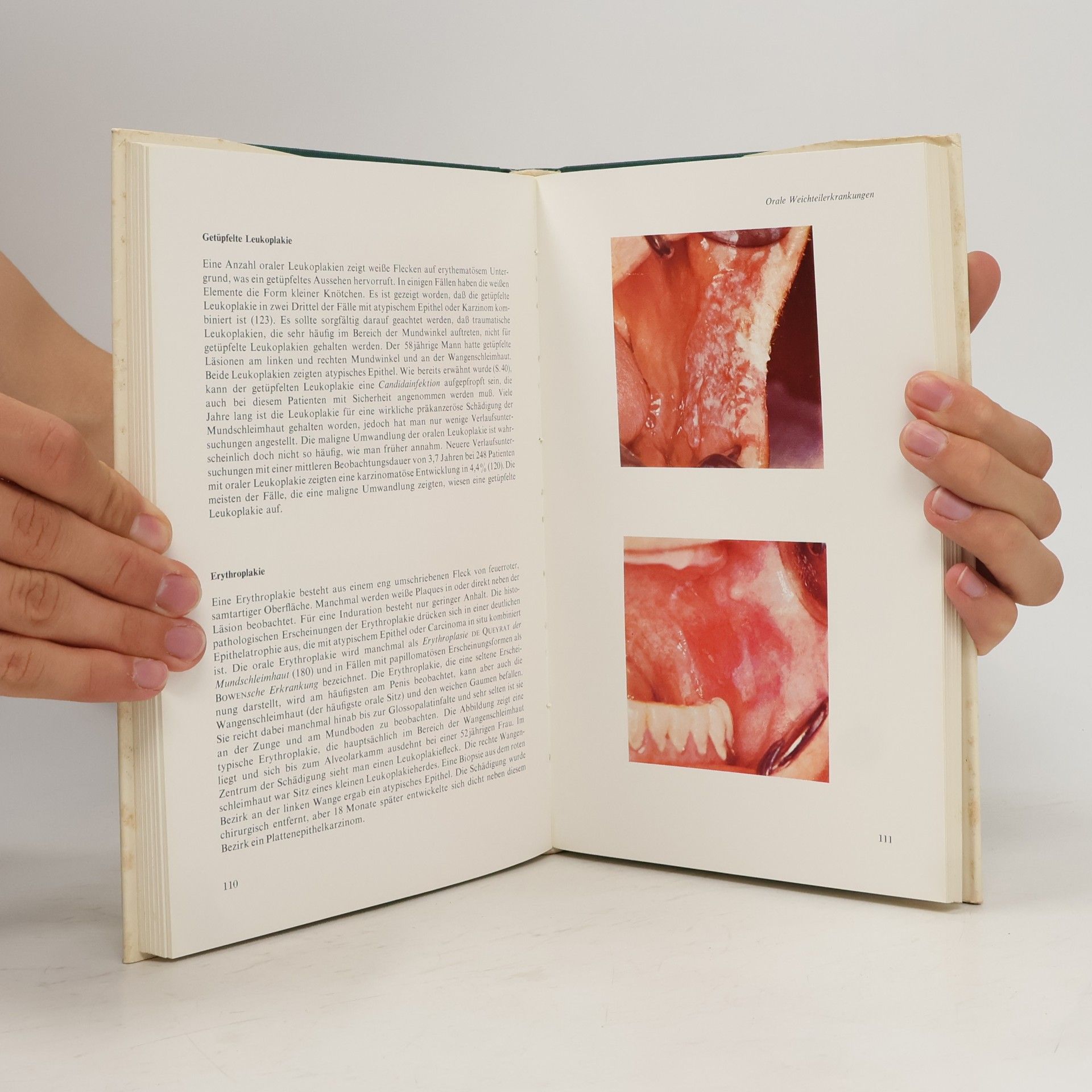 Jens Jørgen Pindborg Atlas der Erkrankungen der Mundschleimhaut
