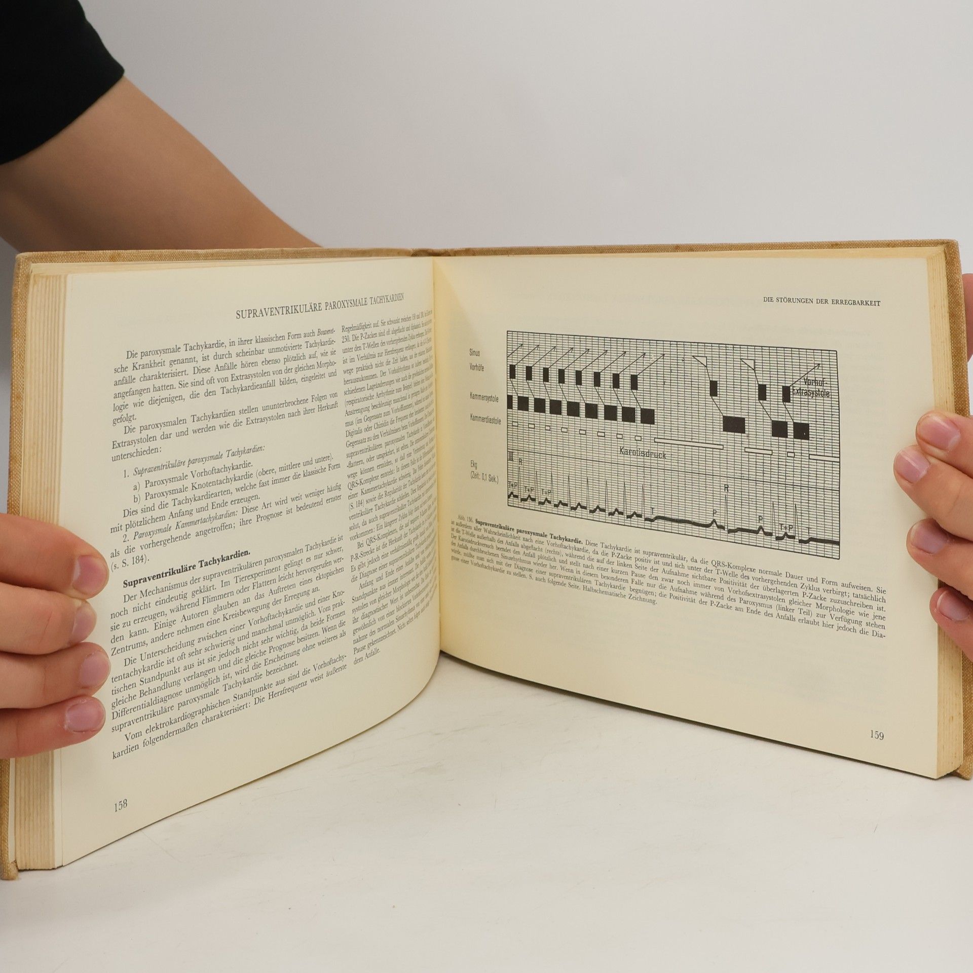 O. Ritter Atlas der Elektrokardiographie