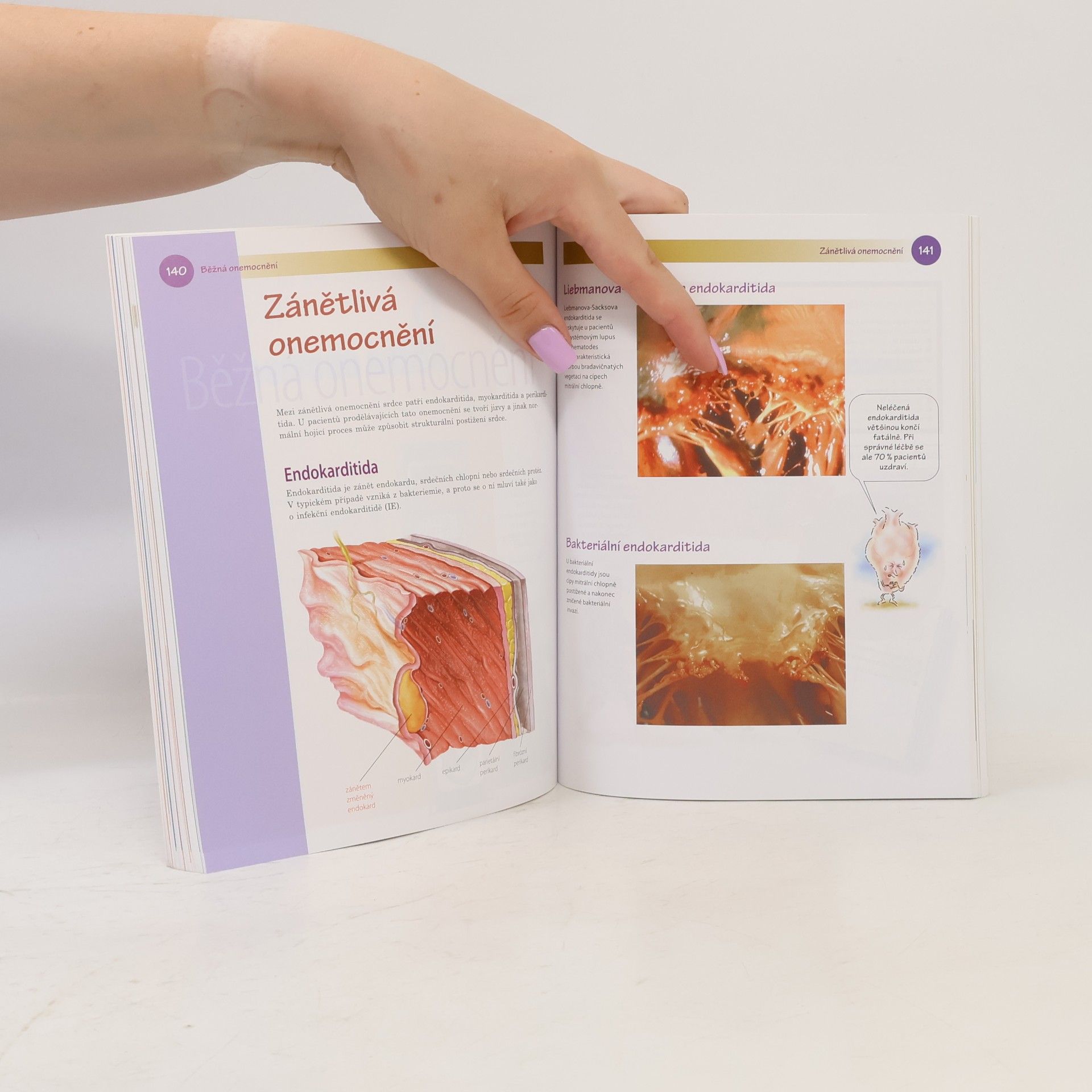 Auteurscollectief Kardiologie pro sestry
