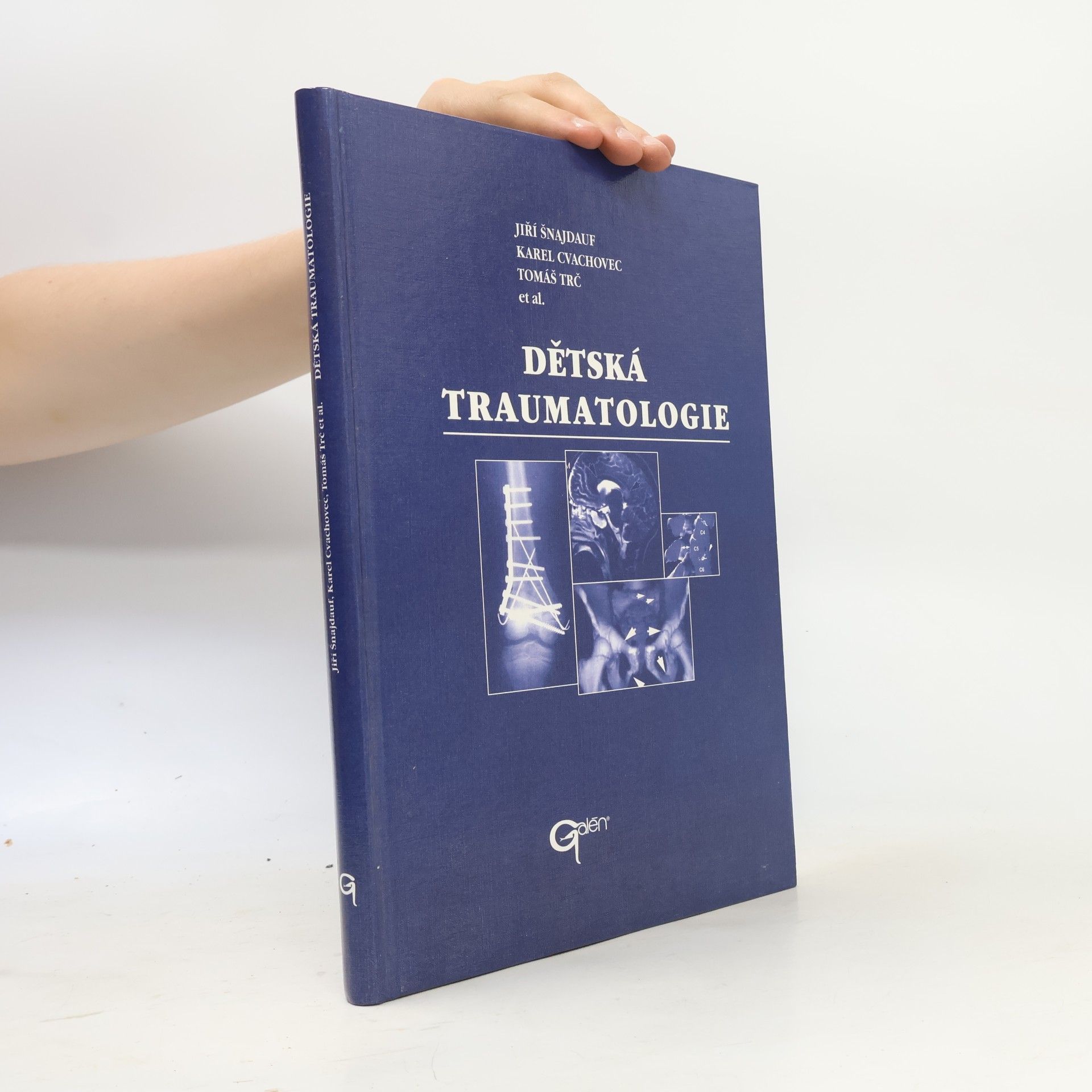 Dětská traumatologie