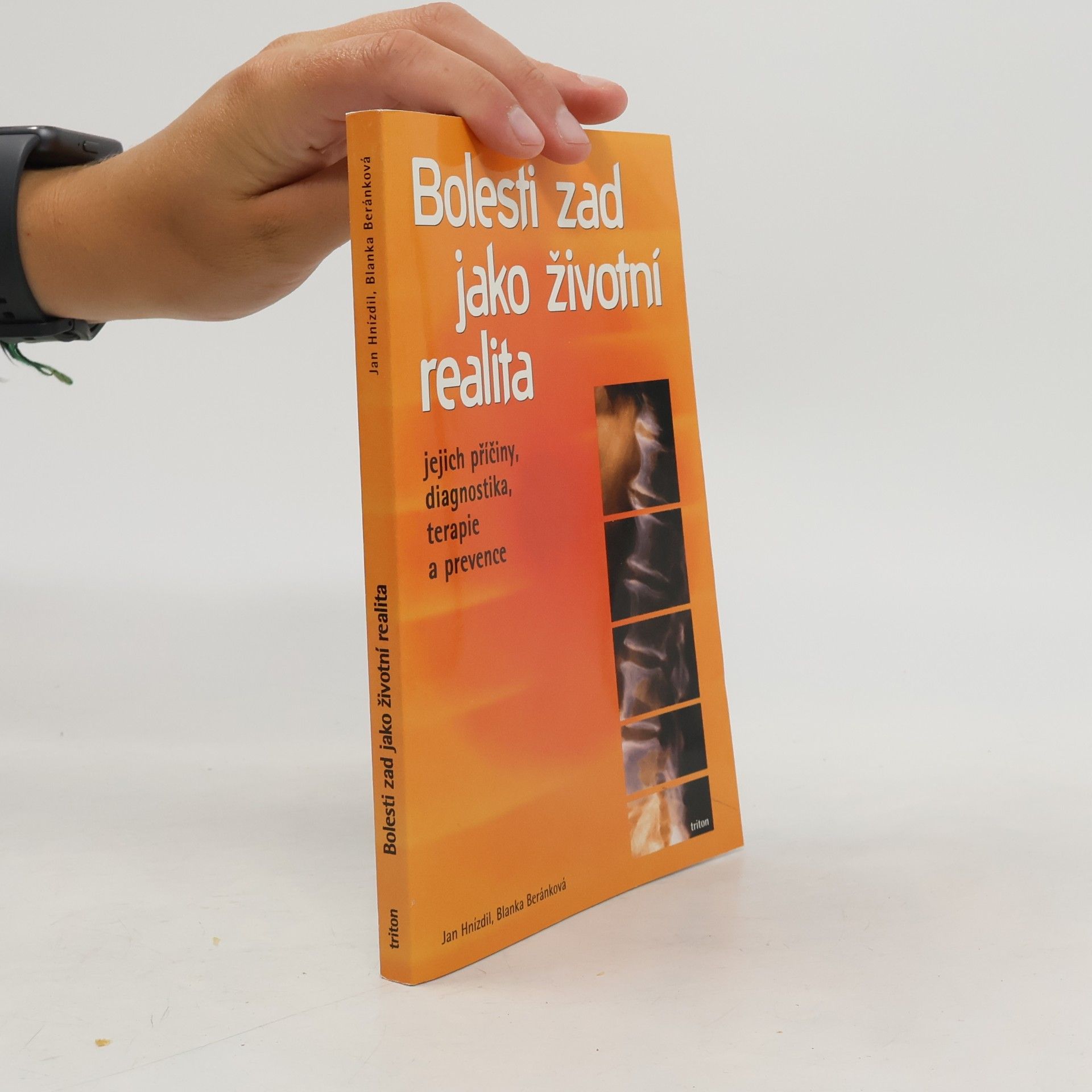 Jan Hnízdil Bolesti zad jako životní realita. Jejich příčiny, diagnostika, terapie a prevence
