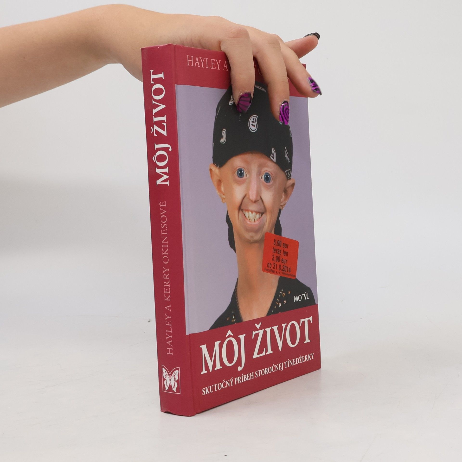 Hayley Okines Môj život