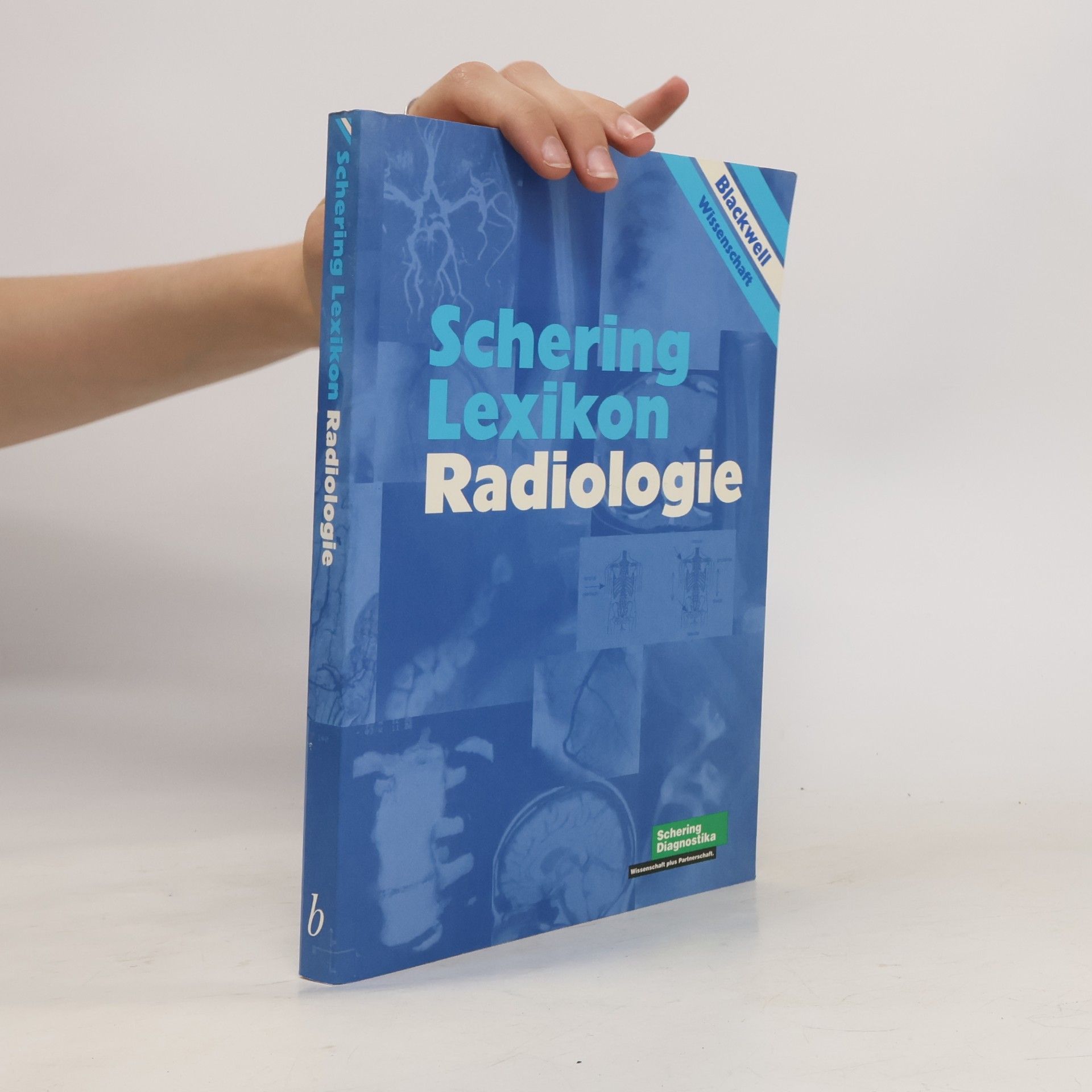 Autorenkollektiv Schering Lexikon Radiologie