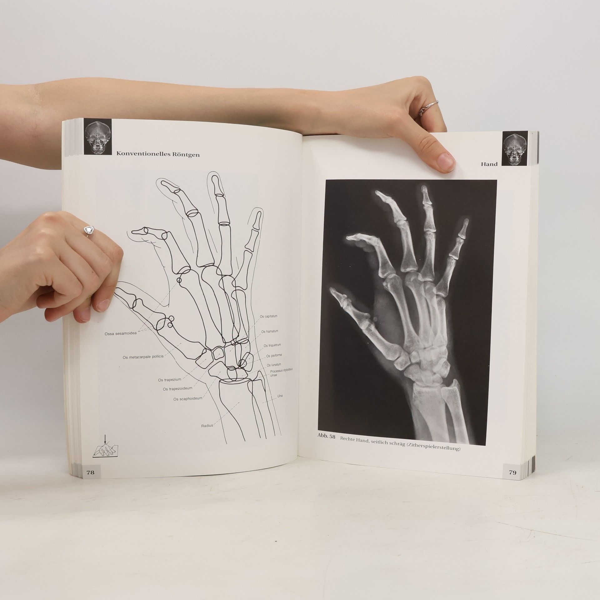 Lothar Wicke Atlas der Röntgenanatomie