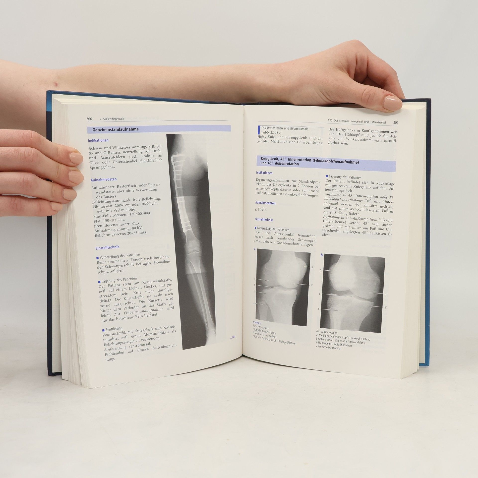 Marianne Zimmer-Brossy Lehrbuch der Röntgendiagnostischen Einstelltechnik - 5. Auflage