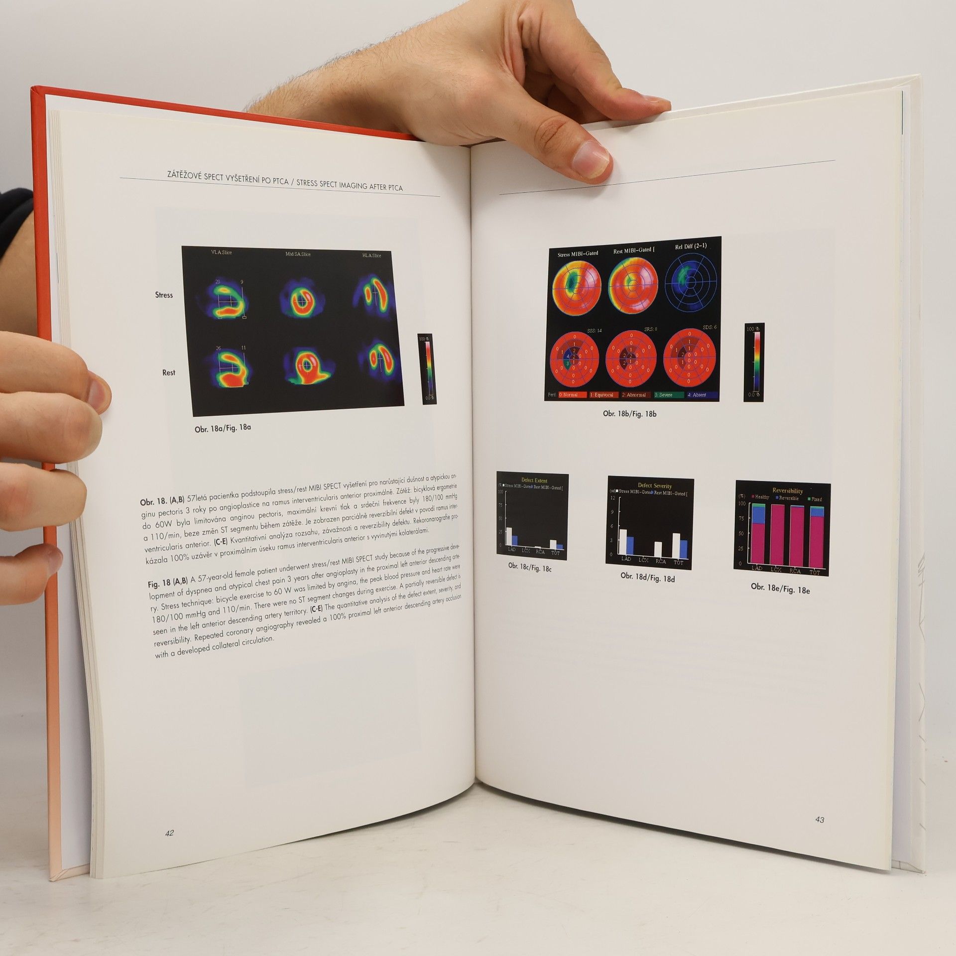 Milan Kamínek Atlas of Nuclear Cardiology. Atlas nukleární kardiologie