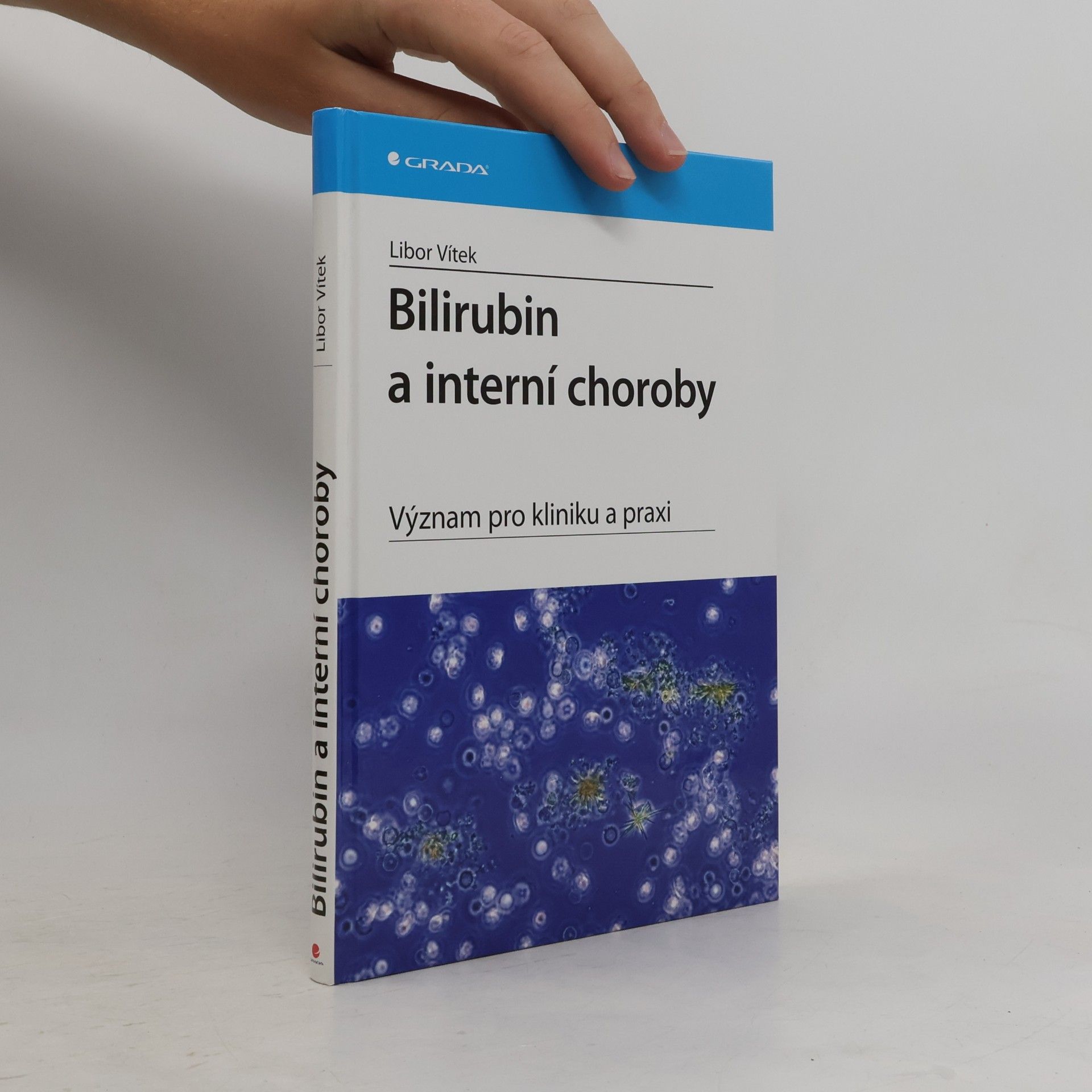 Libor Vítek Bilirubin a interní choroby