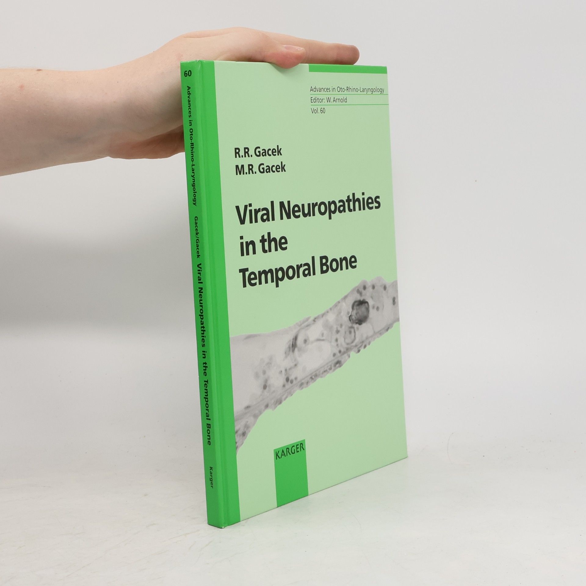 Richard R. Gacek Advances in Oto-Rhino-Laryngology - 60: Viral Neuropathies of the Temporal Bone