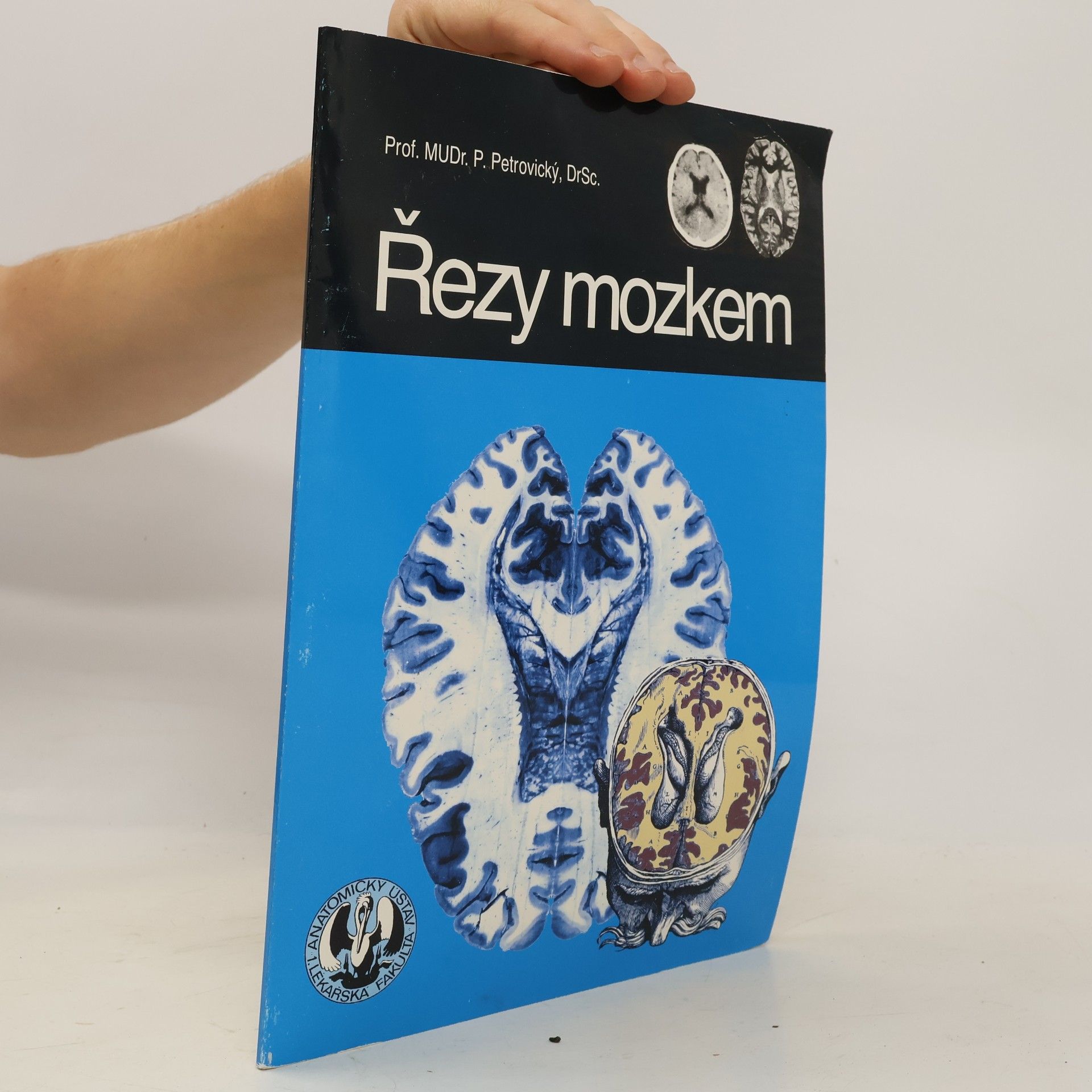 Pavel Petrovický Řezy mozkem : Neuroanatomie, CT, NMR
