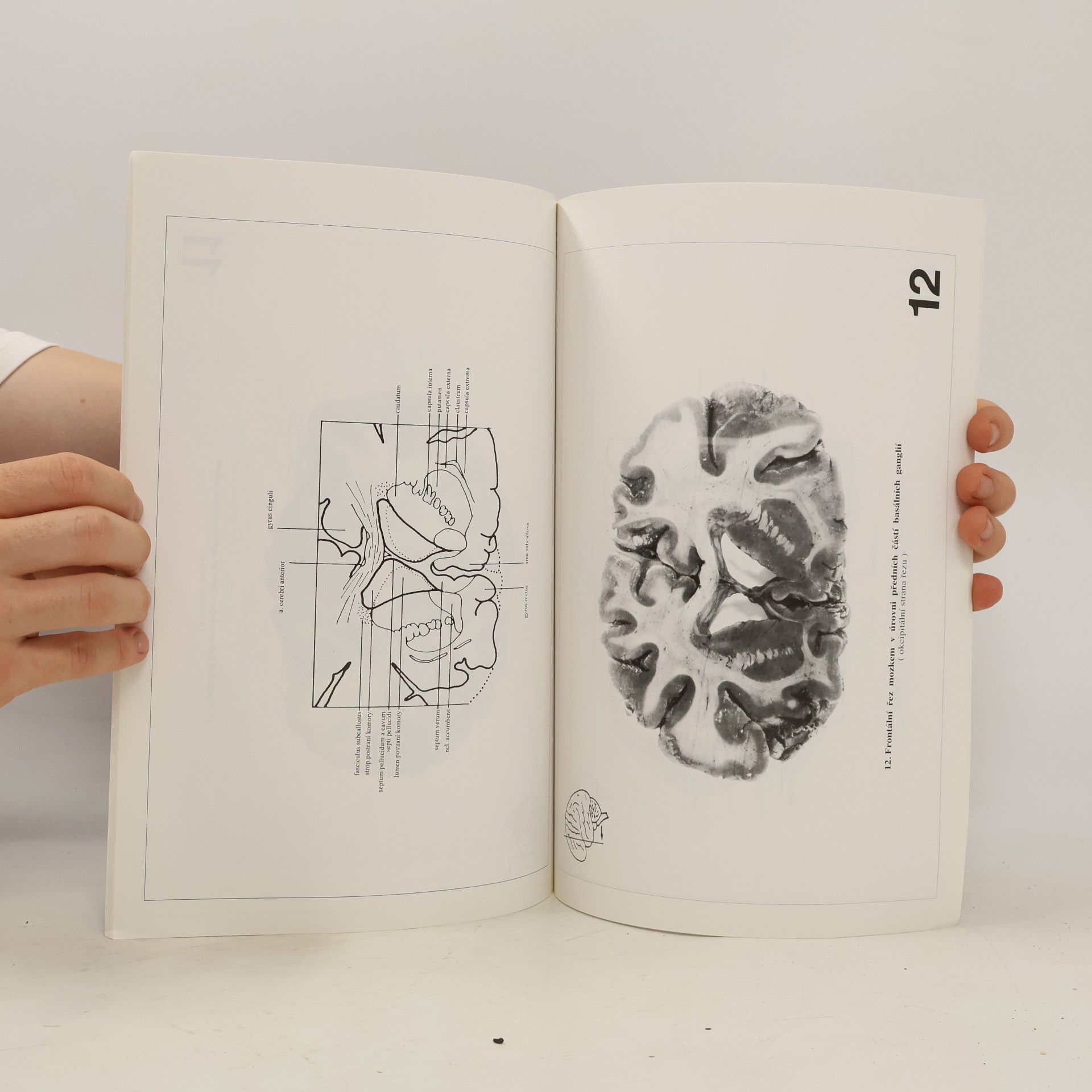 Pavel Petrovický Řezy mozkem : Neuroanatomie, CT, NMR
