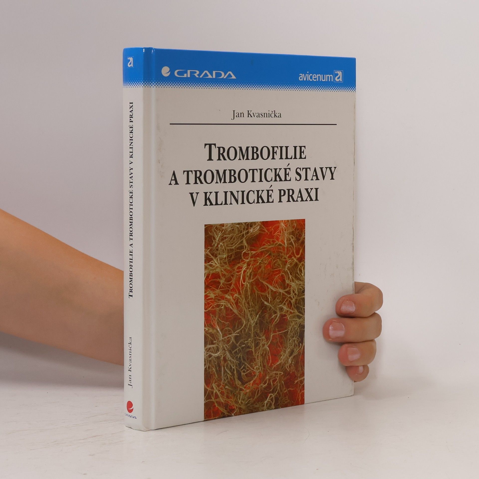Jan Kvasnička Trombofilie a trombotické stavy v klinické praxi