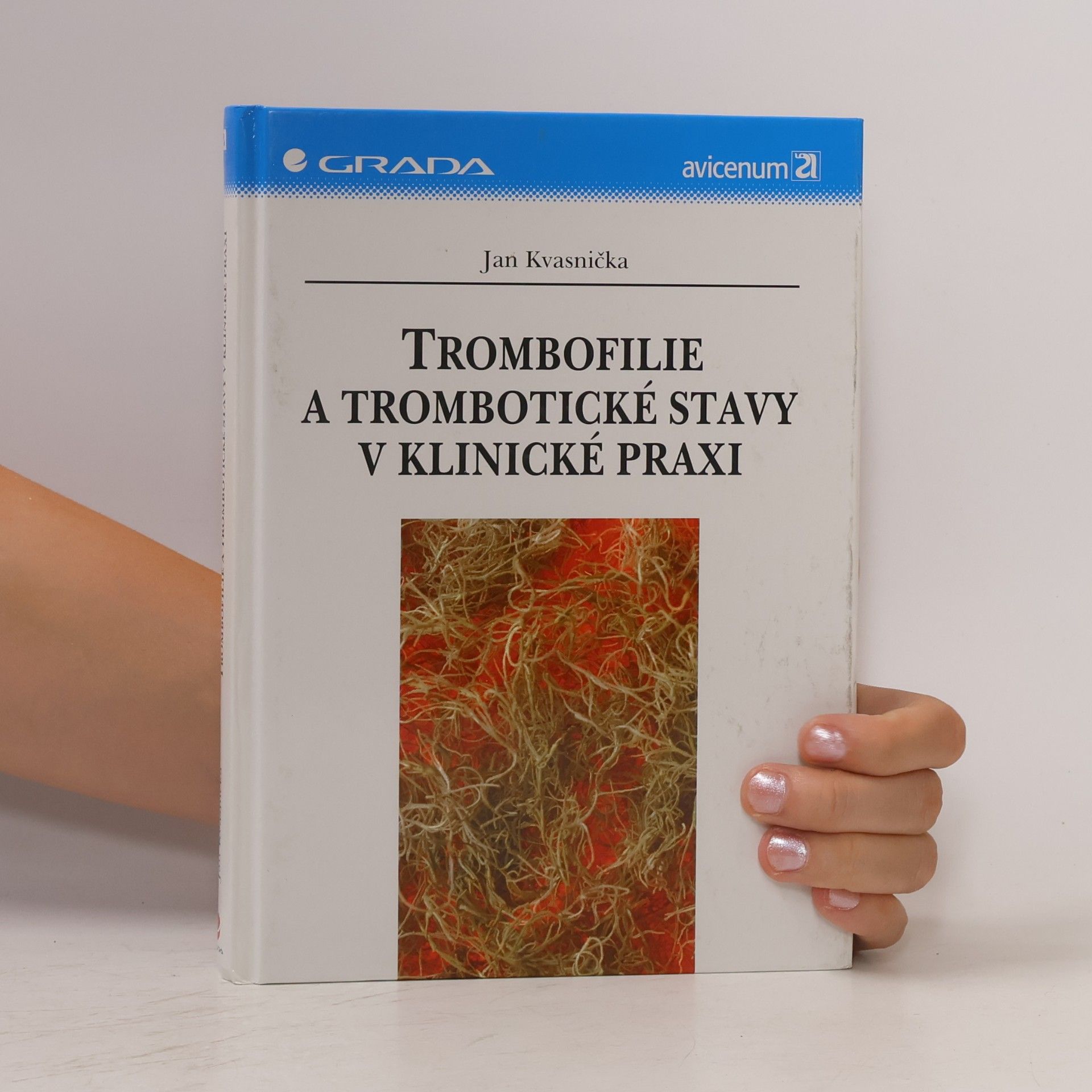 Jan Kvasnička Trombofilie a trombotické stavy v klinické praxi