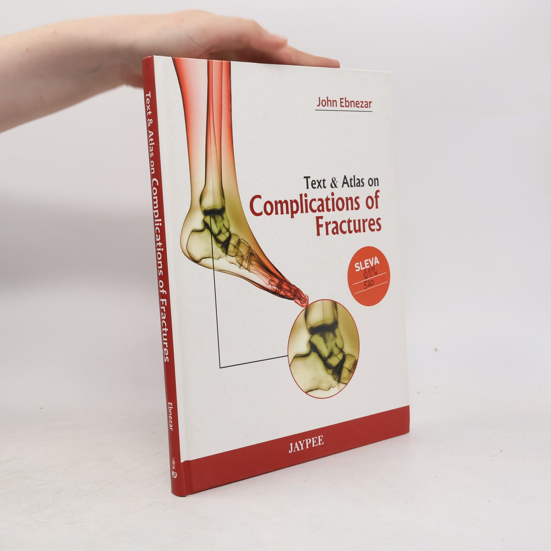 John Ebnezar Text & Atlas on Complications of Fractures