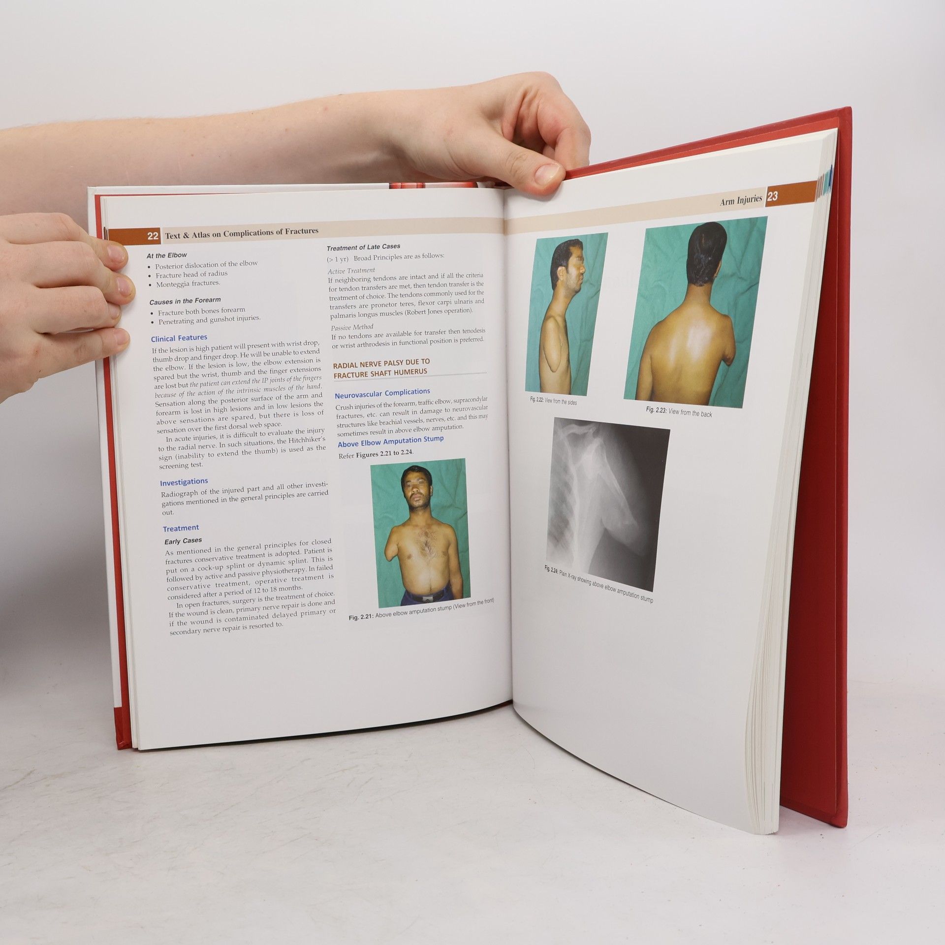 John Ebnezar Text & Atlas on Complications of Fractures