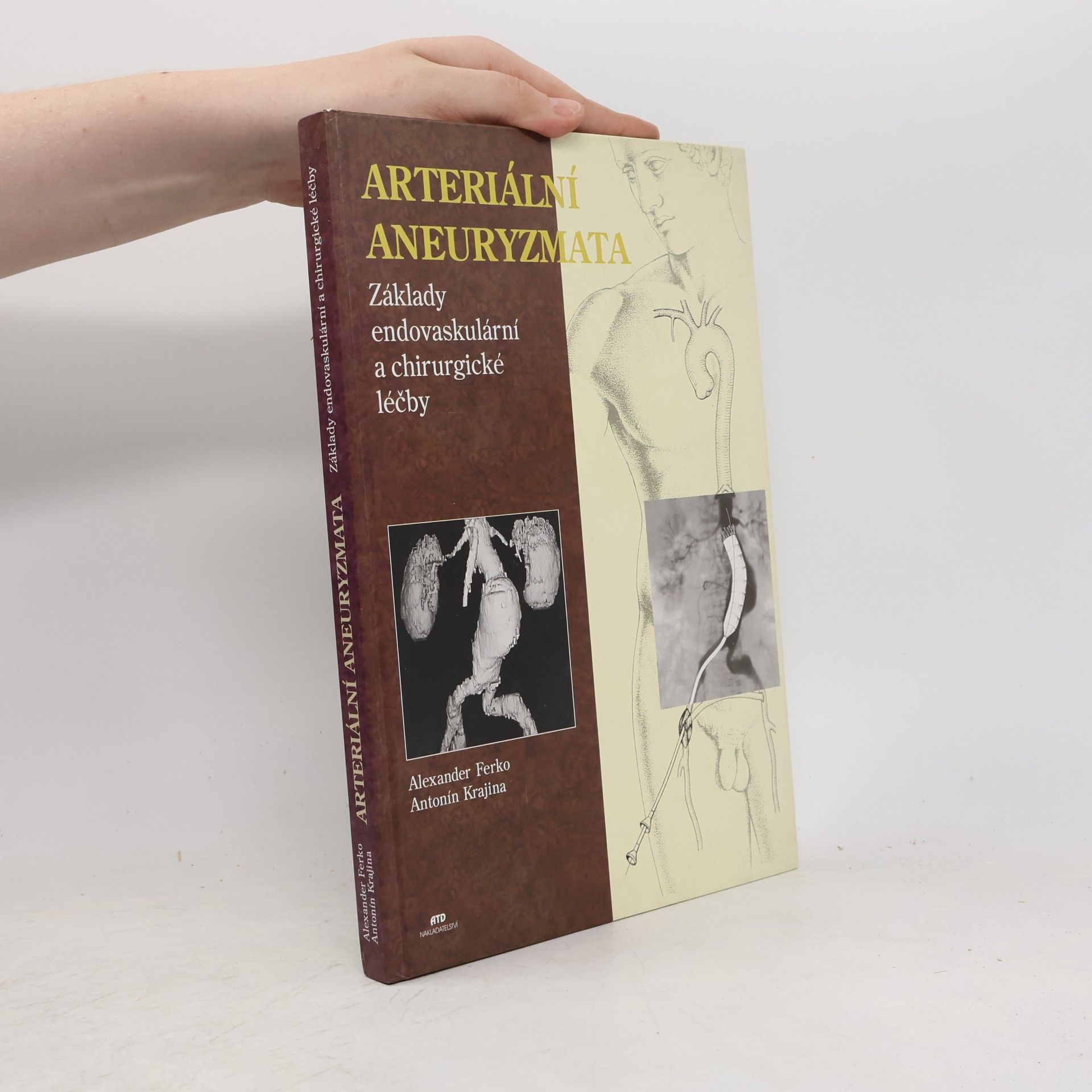 Arteriální aneurizmata