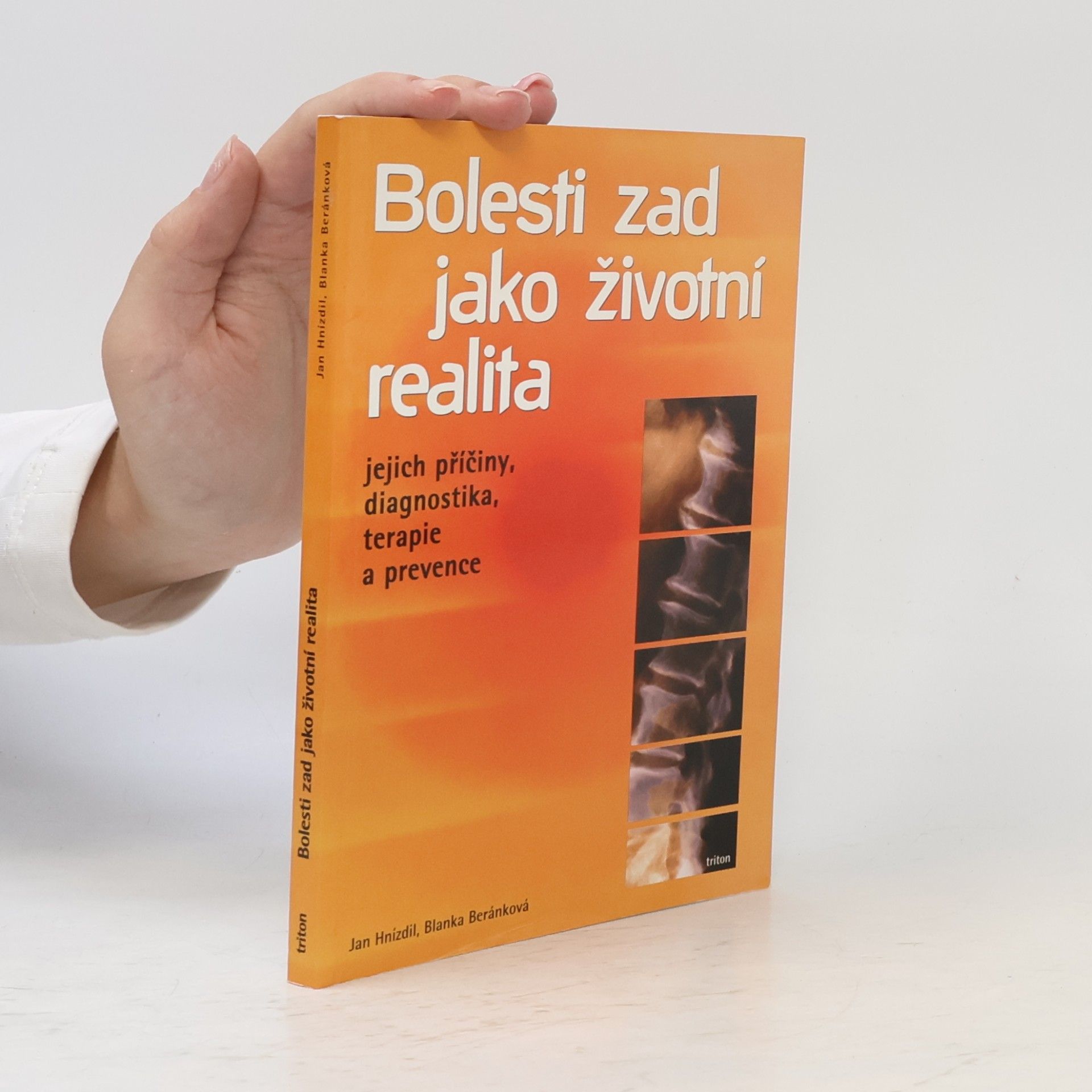 Jan Hnízdil Bolesti zad jako životní realita. Jejich příčiny, diagnostika, terapie a prevence
