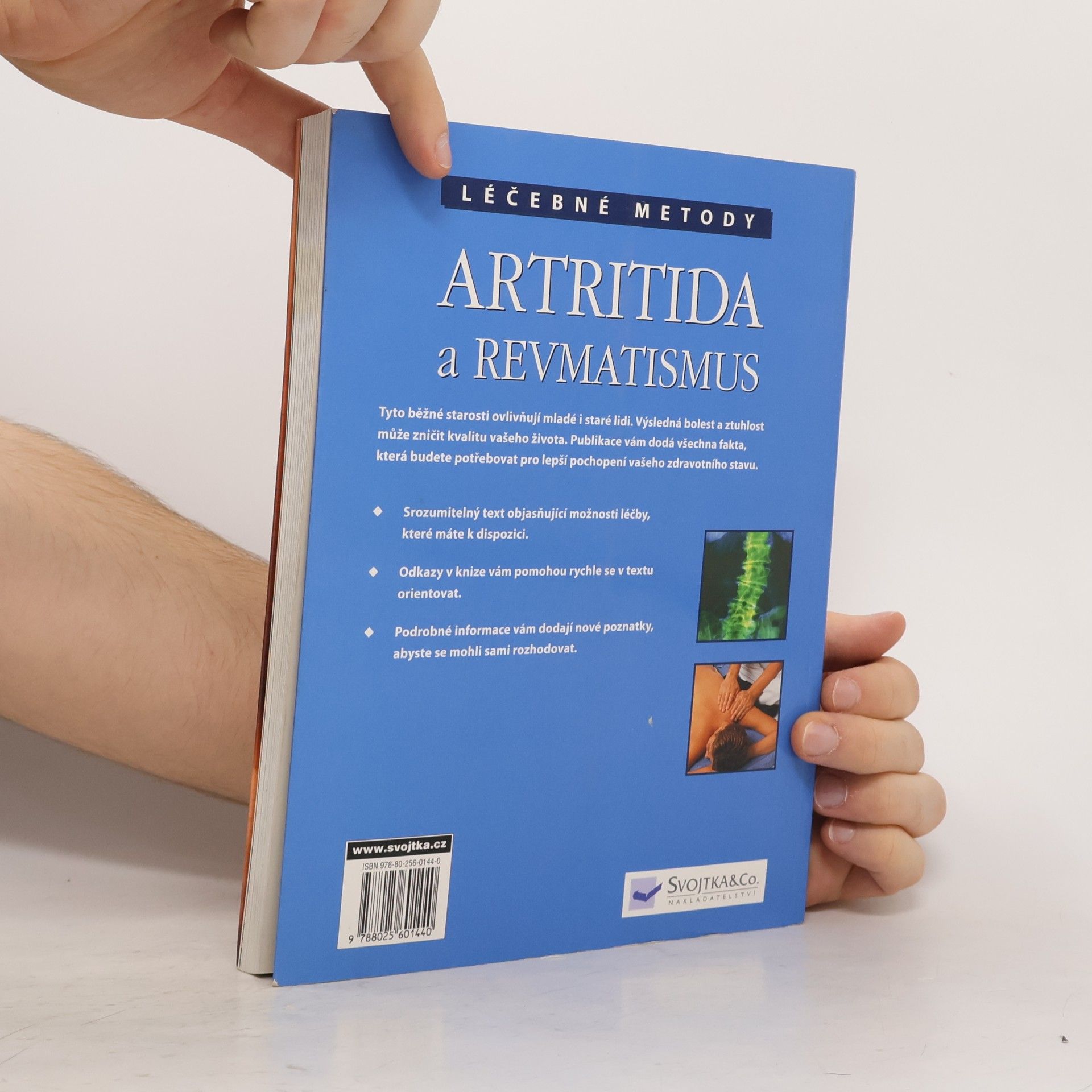 Anne Charlish Artritida a revmatismus