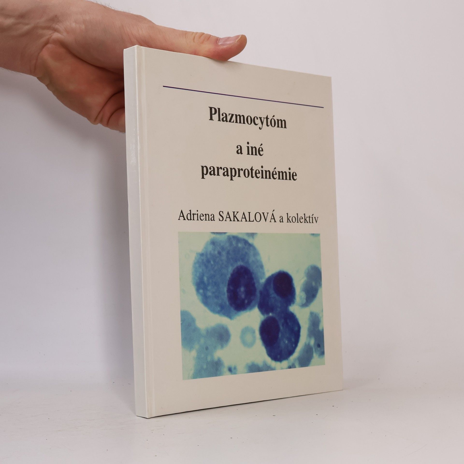 Plazmocytóm a iné paraproteinémie