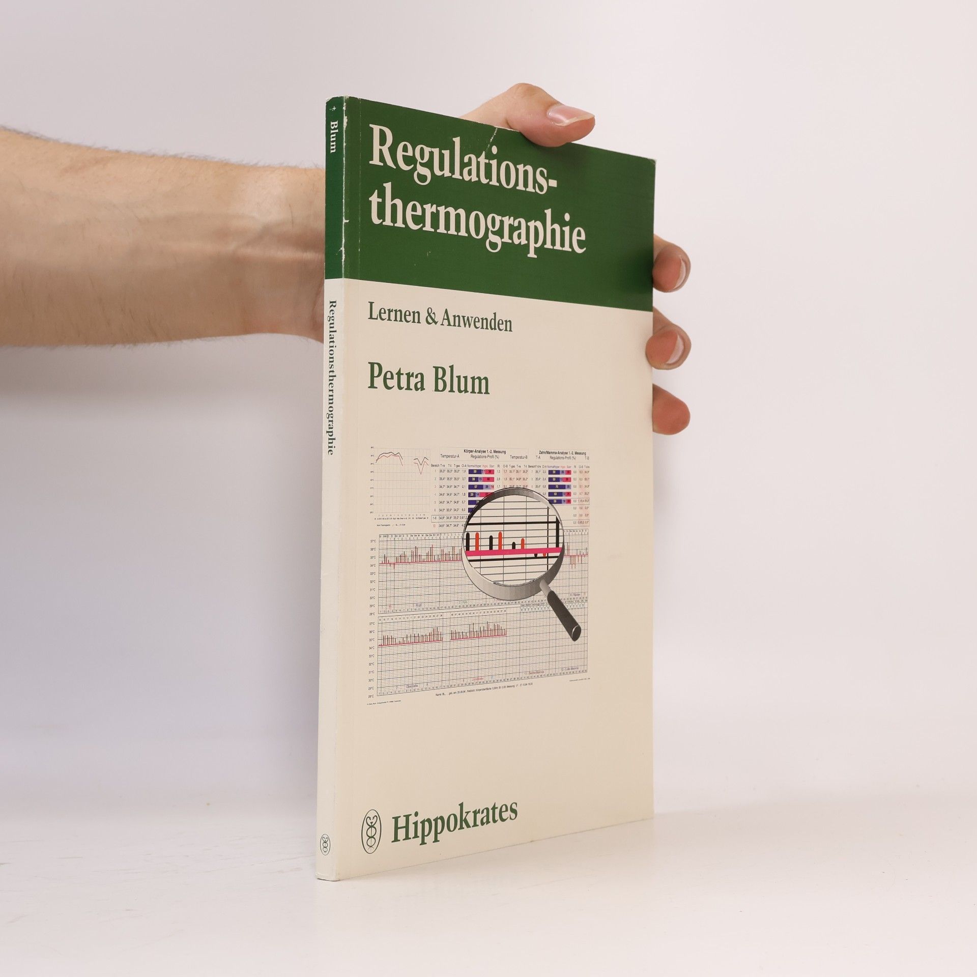 Regulationsthermographie