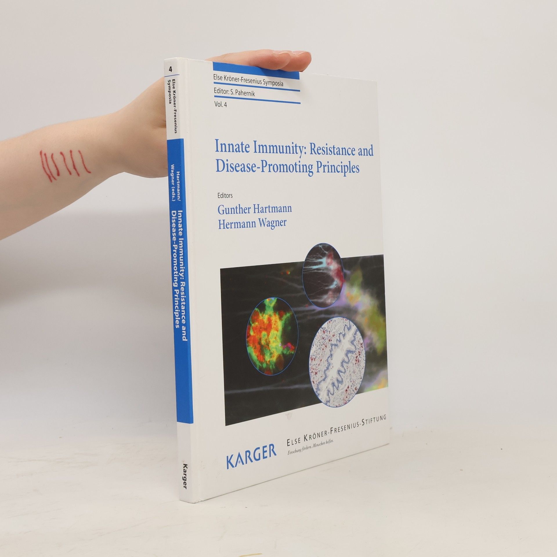 Innate immunity