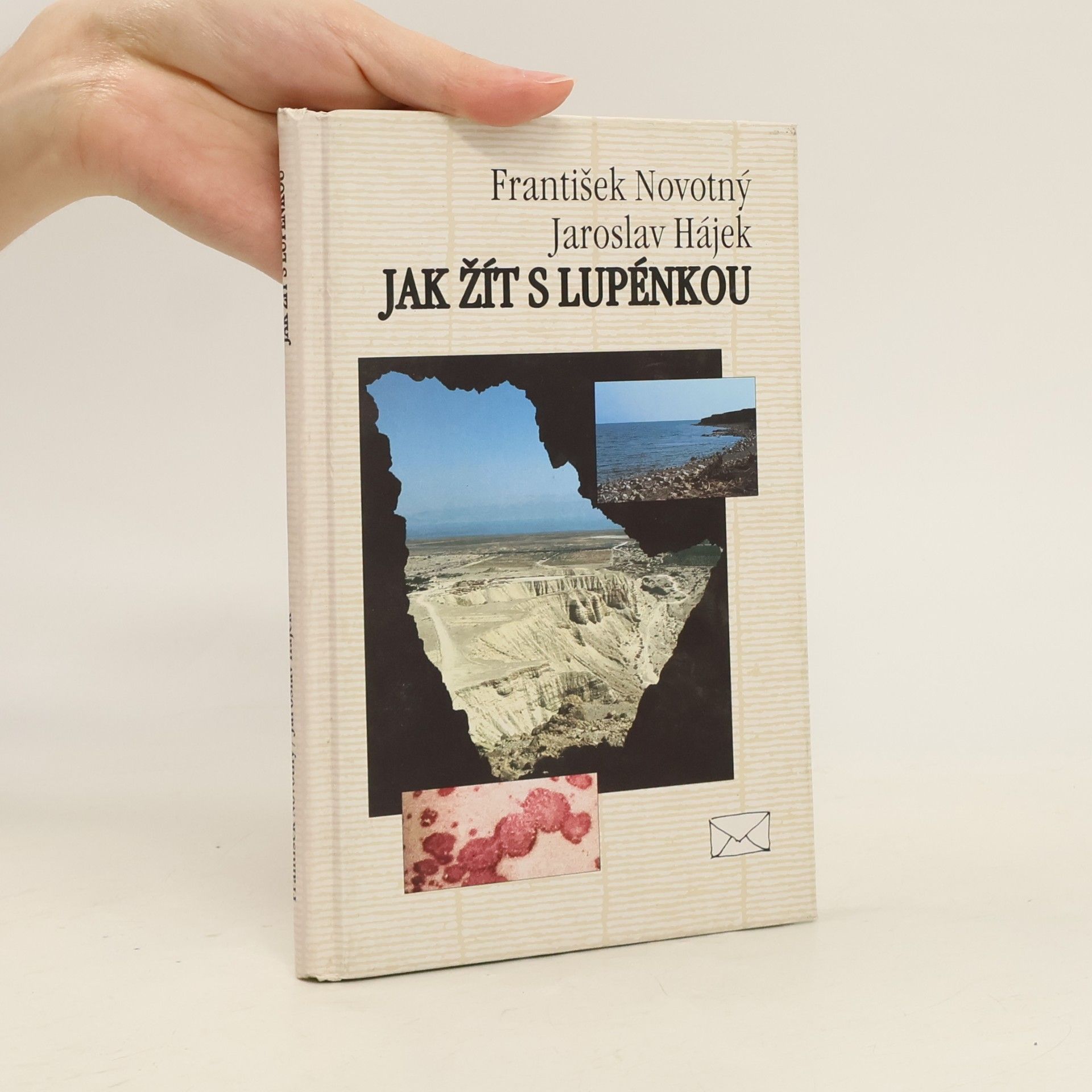 Jak žít s lupénkou