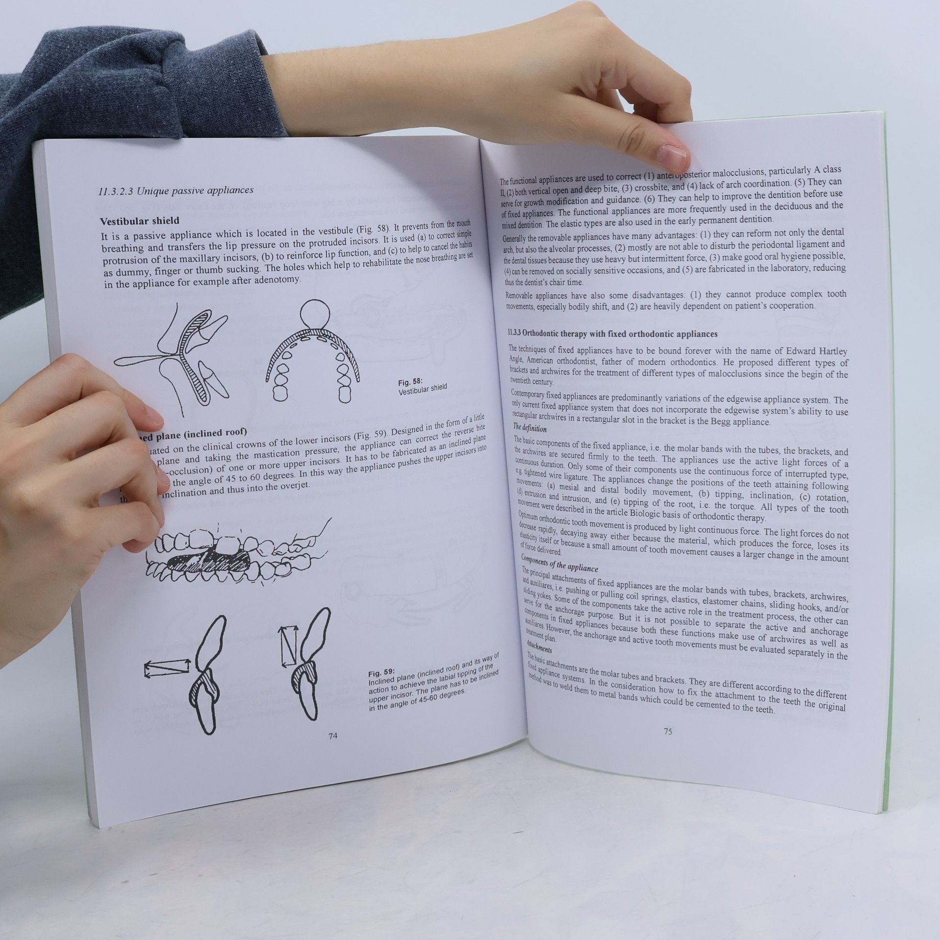 Irena Šubrtová Orthodontics Selected Chapters
