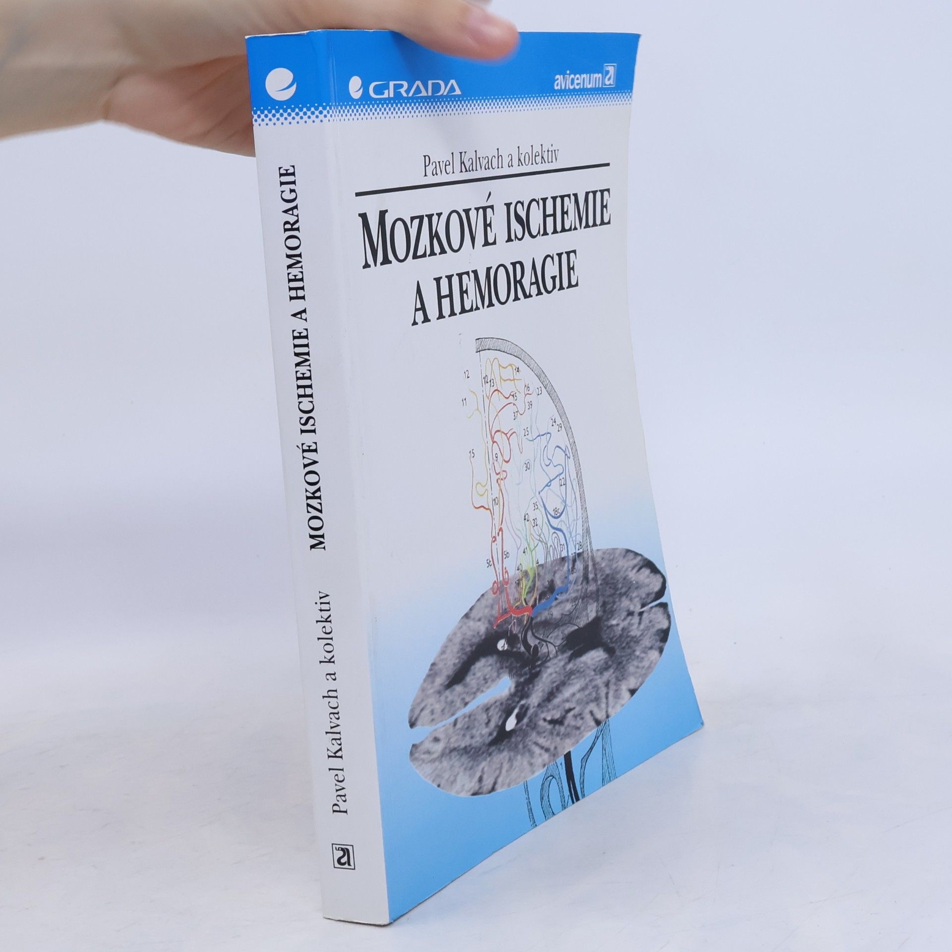 Pavel Kalvach Mozkové ischemie a hemoragie