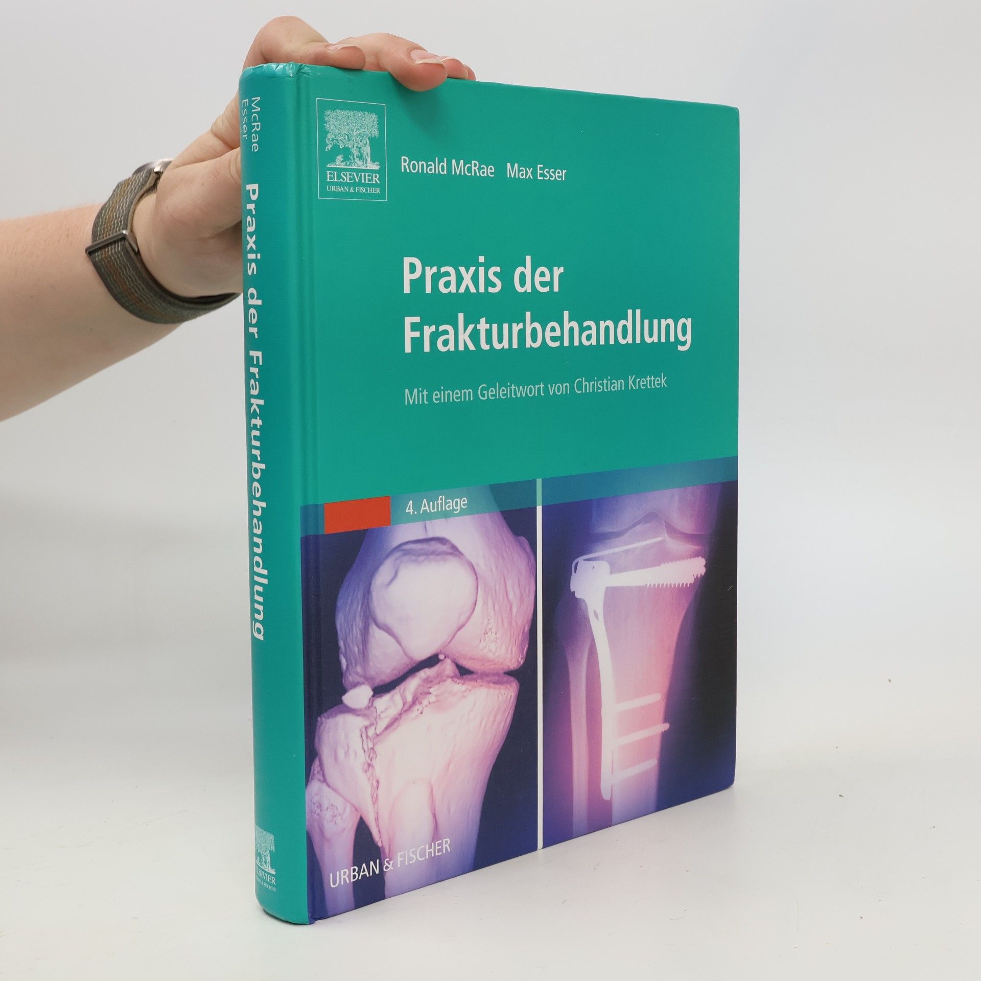 Max Esser Praxis der Frakturbehandlung - 4. Auflage