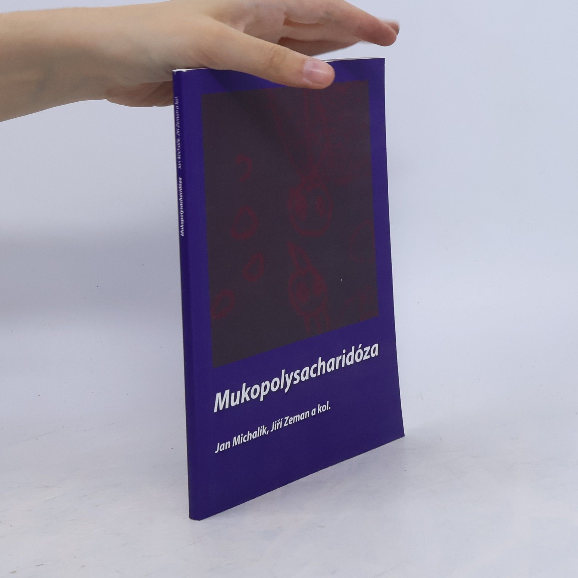 Mukopolysacharidóza