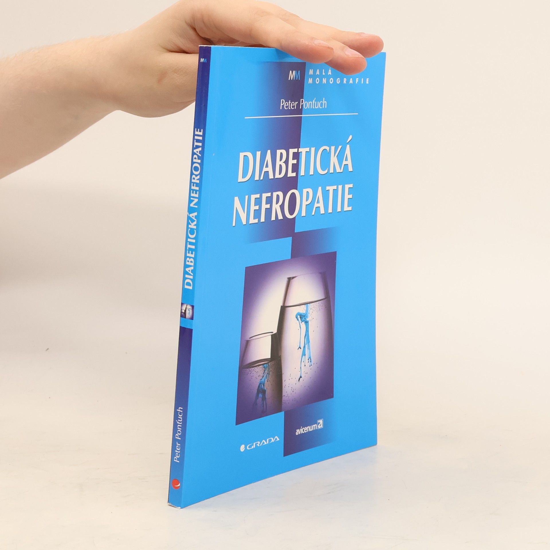 Peter Ponťuch Diabetická nefropatie