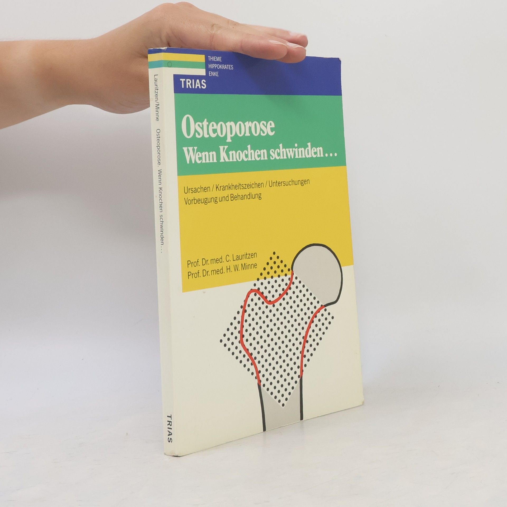 Osteoporose