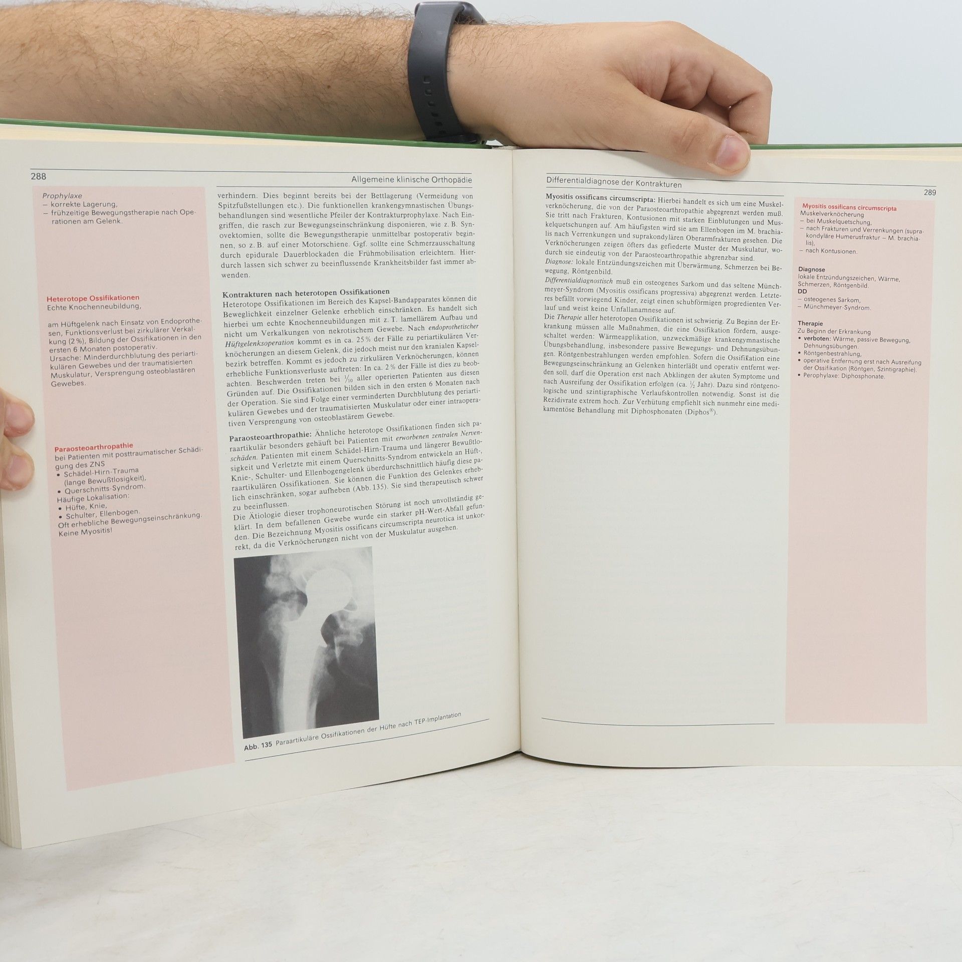Hans Zilch Lehrbuch Orthopädie