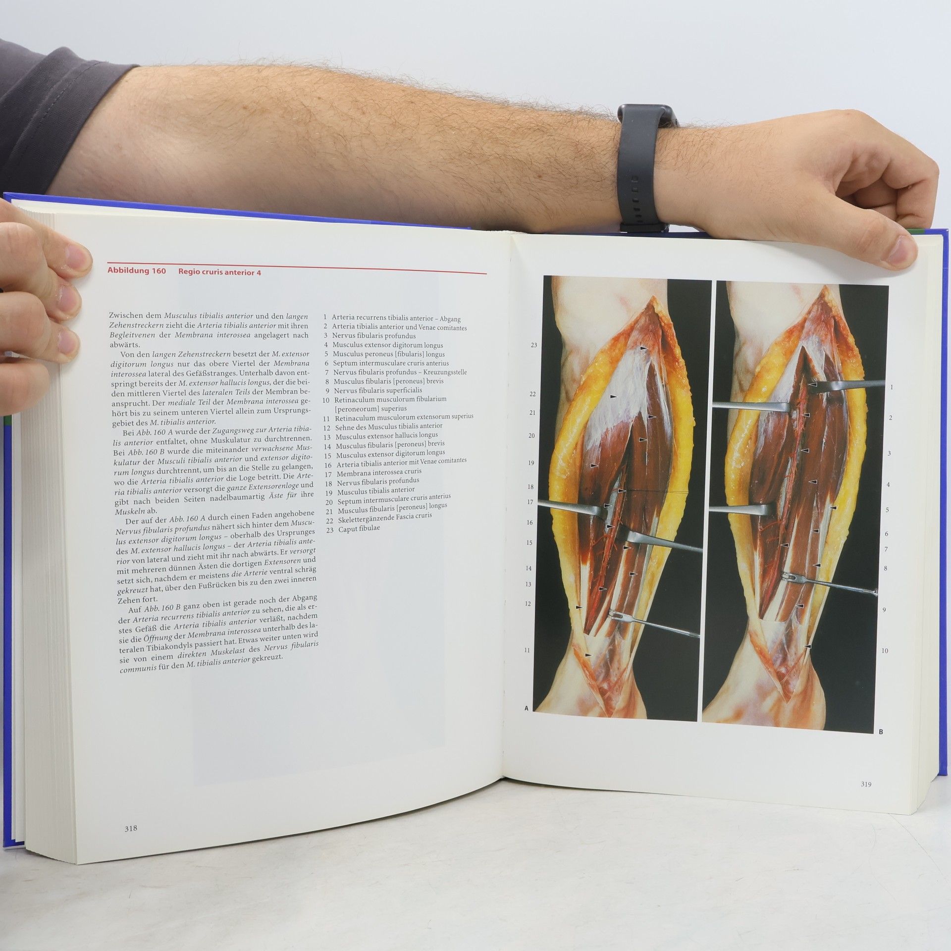 Walter Thiel Photographischer Atlas der praktischen Anatomie