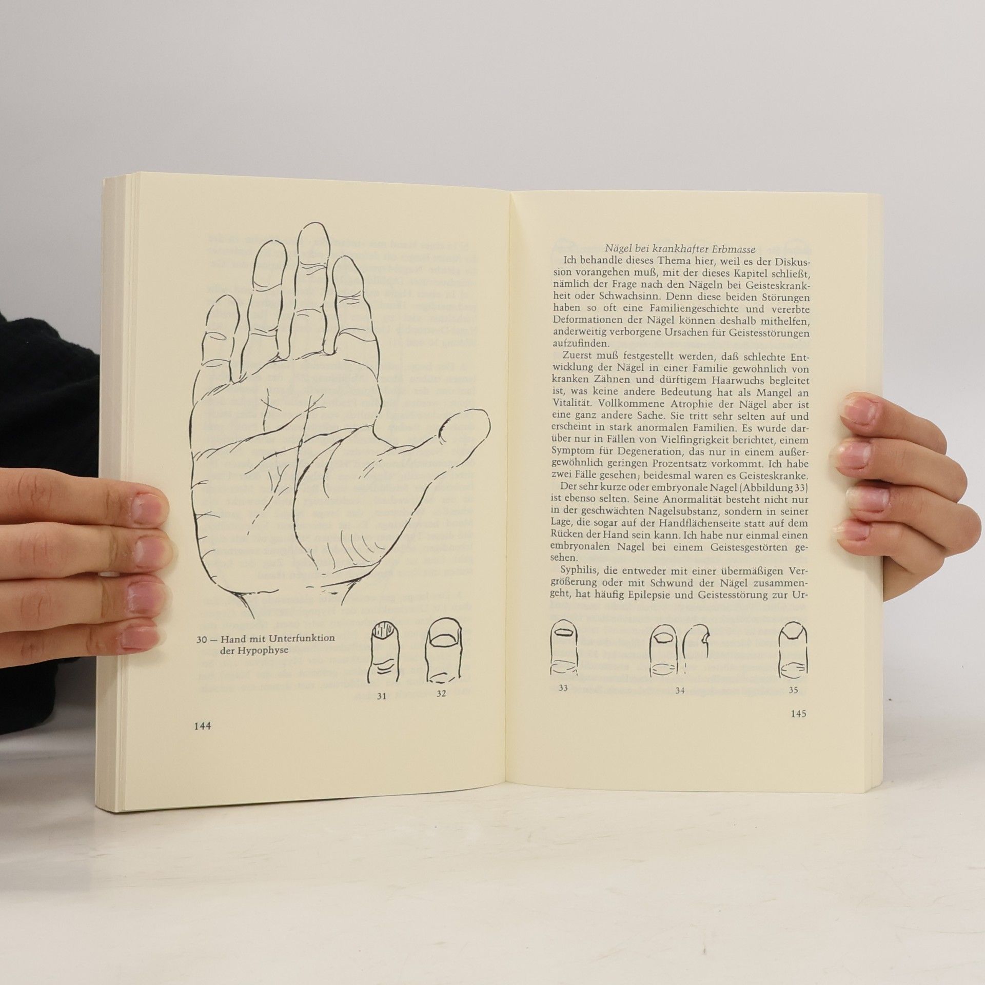 Charlotte Wolff Die Hand als Spiegel der Psyche